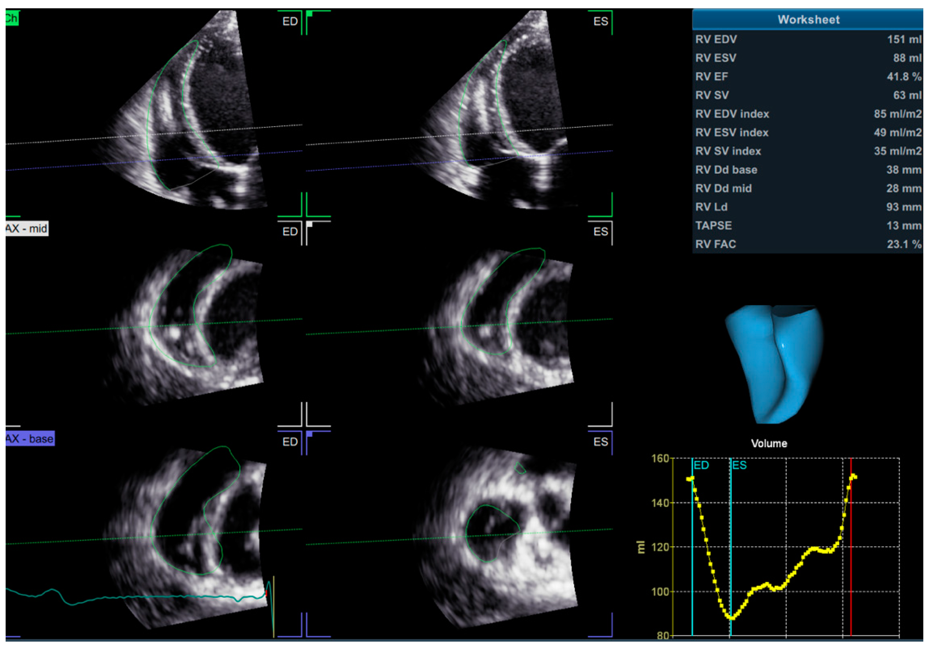 Diagnostics 11 00548 g004