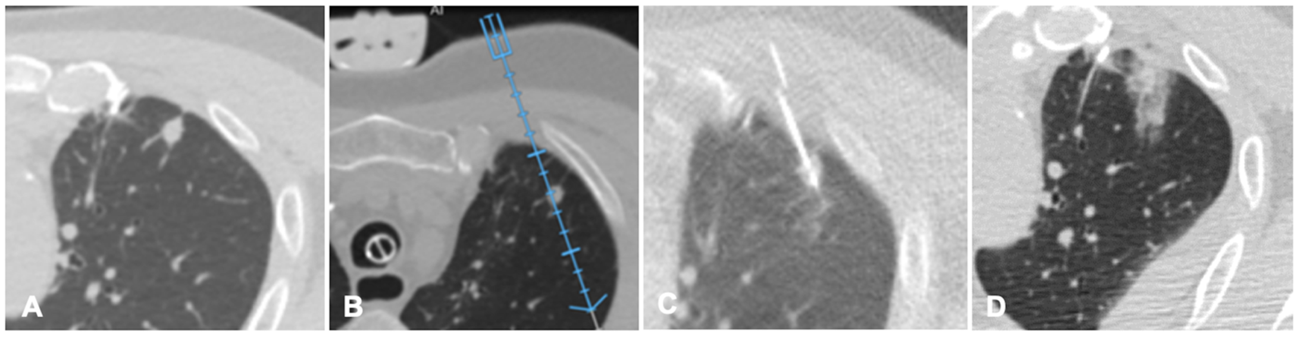 Diagnostics 11 00549 g004
