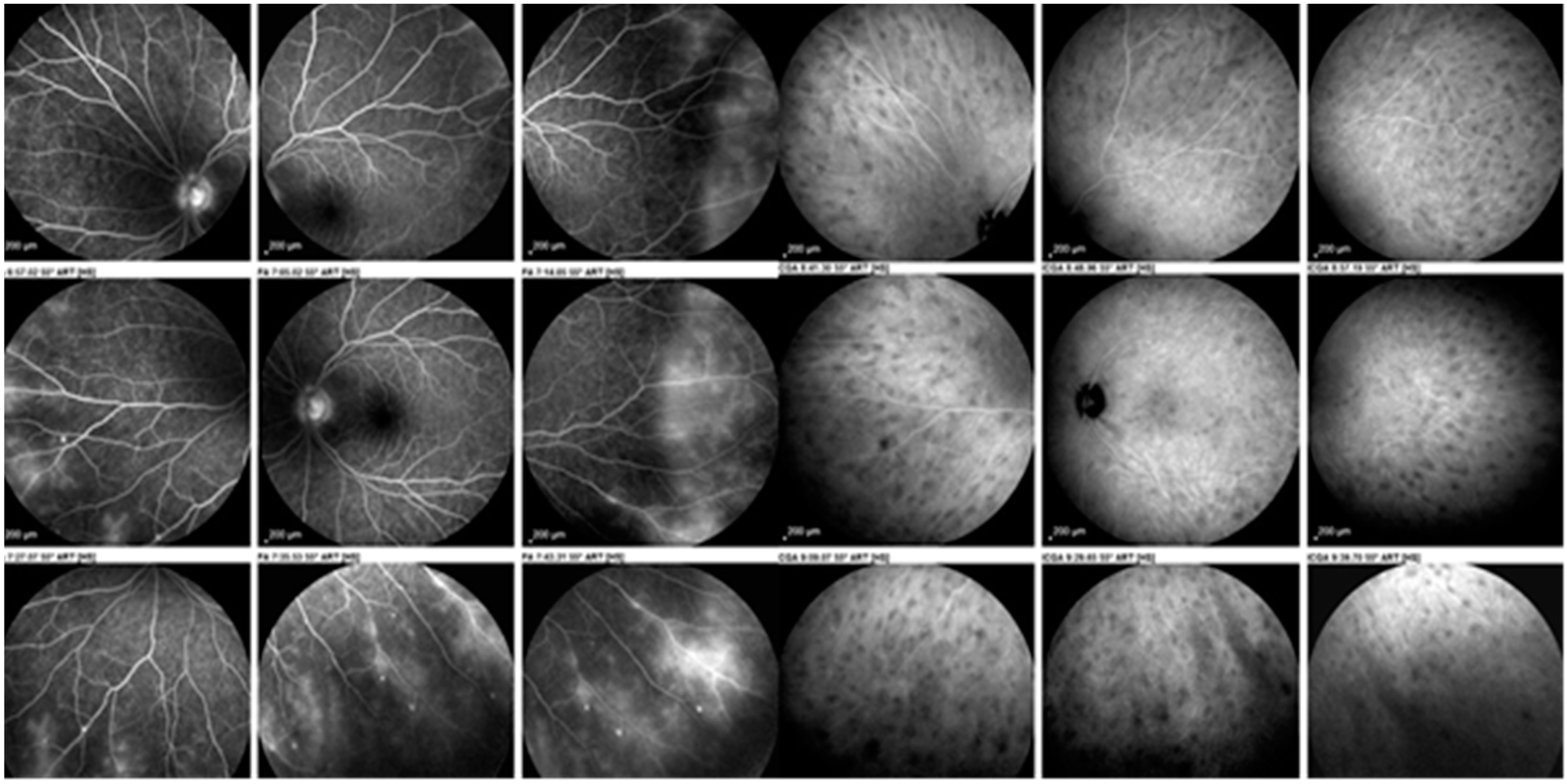 Diagnostics 11 00608 g005 Diagnostics 11 00608 g005