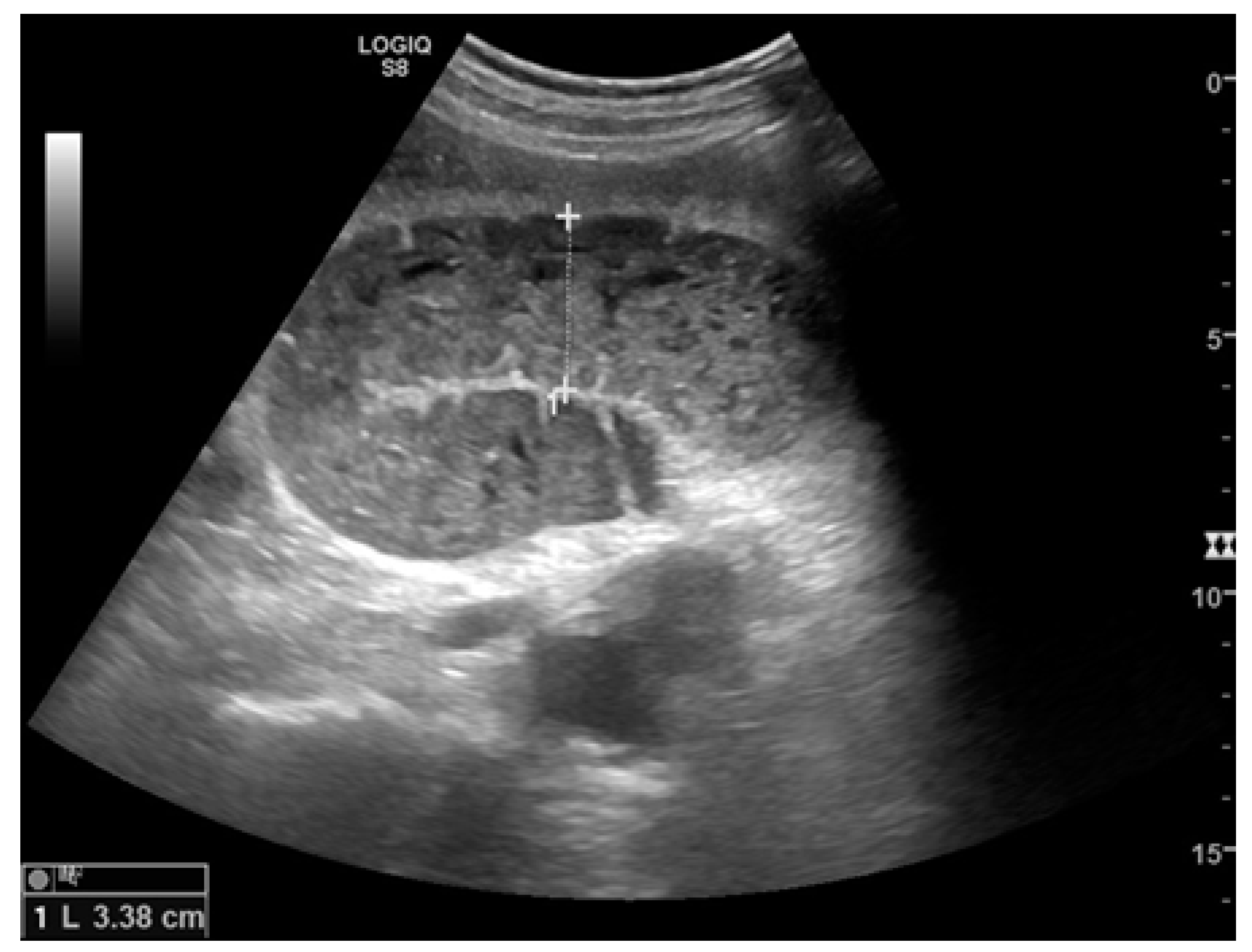 Diagnostics 11 00617 g002