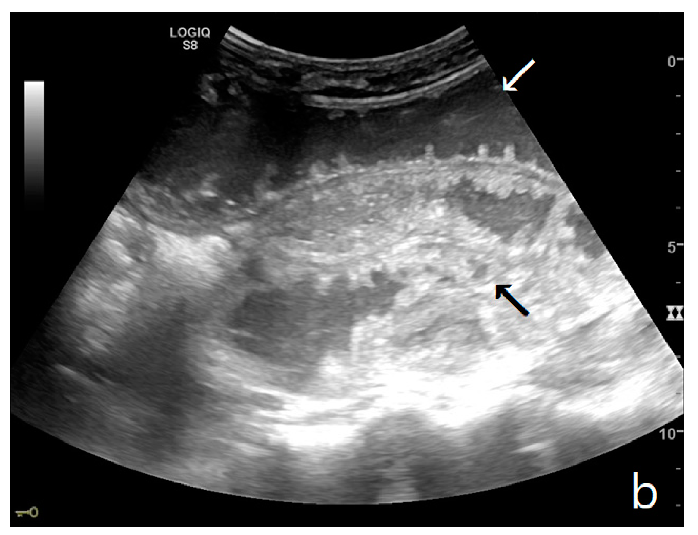 Diagnostics 11 00617 g003b