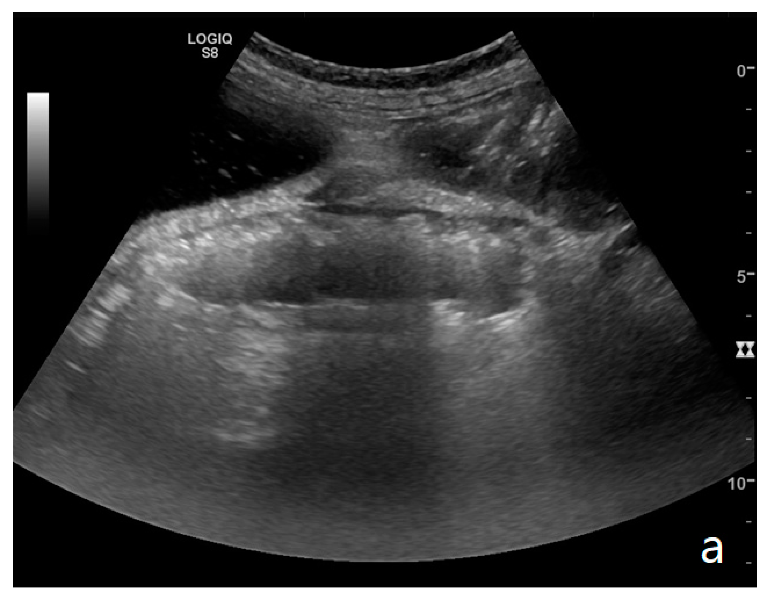 Diagnostics 11 00617 g005a