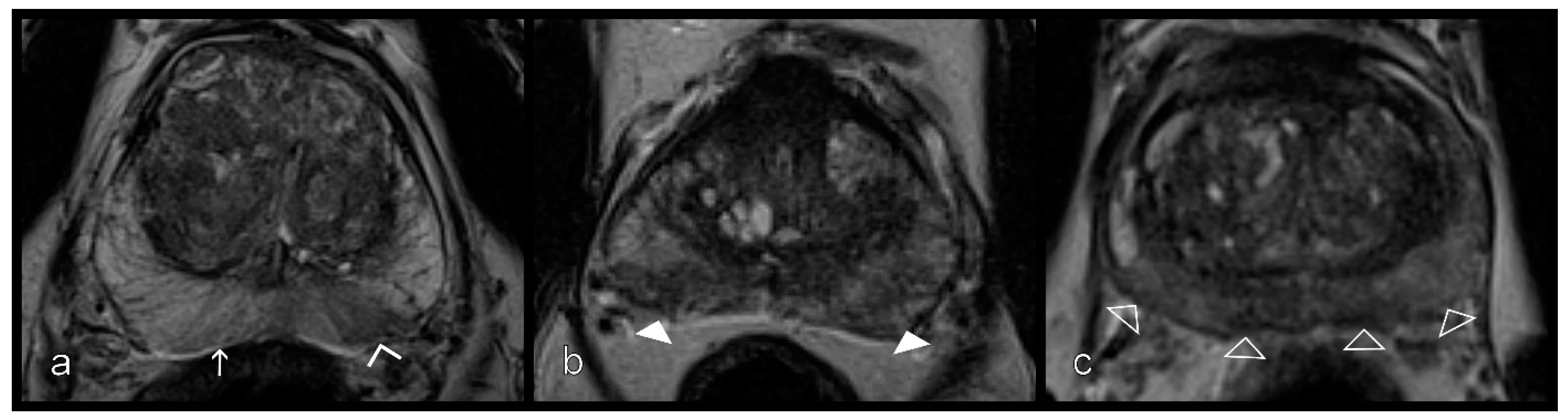 Diagnostics 11 00623 g003