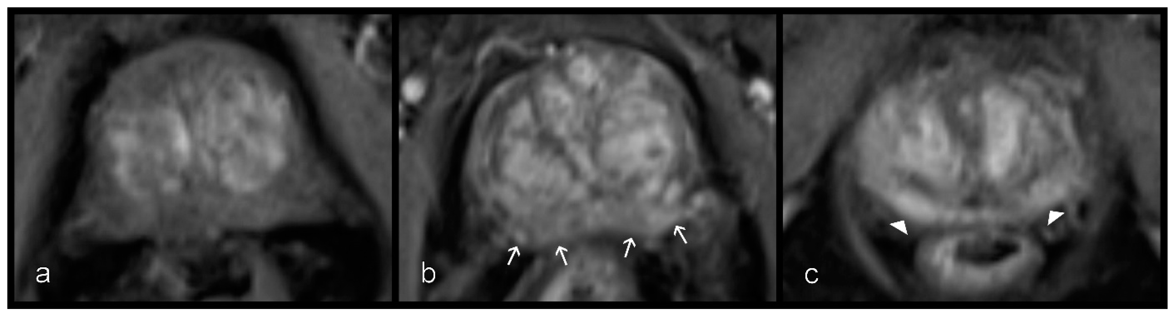 Diagnostics 11 00623 g004