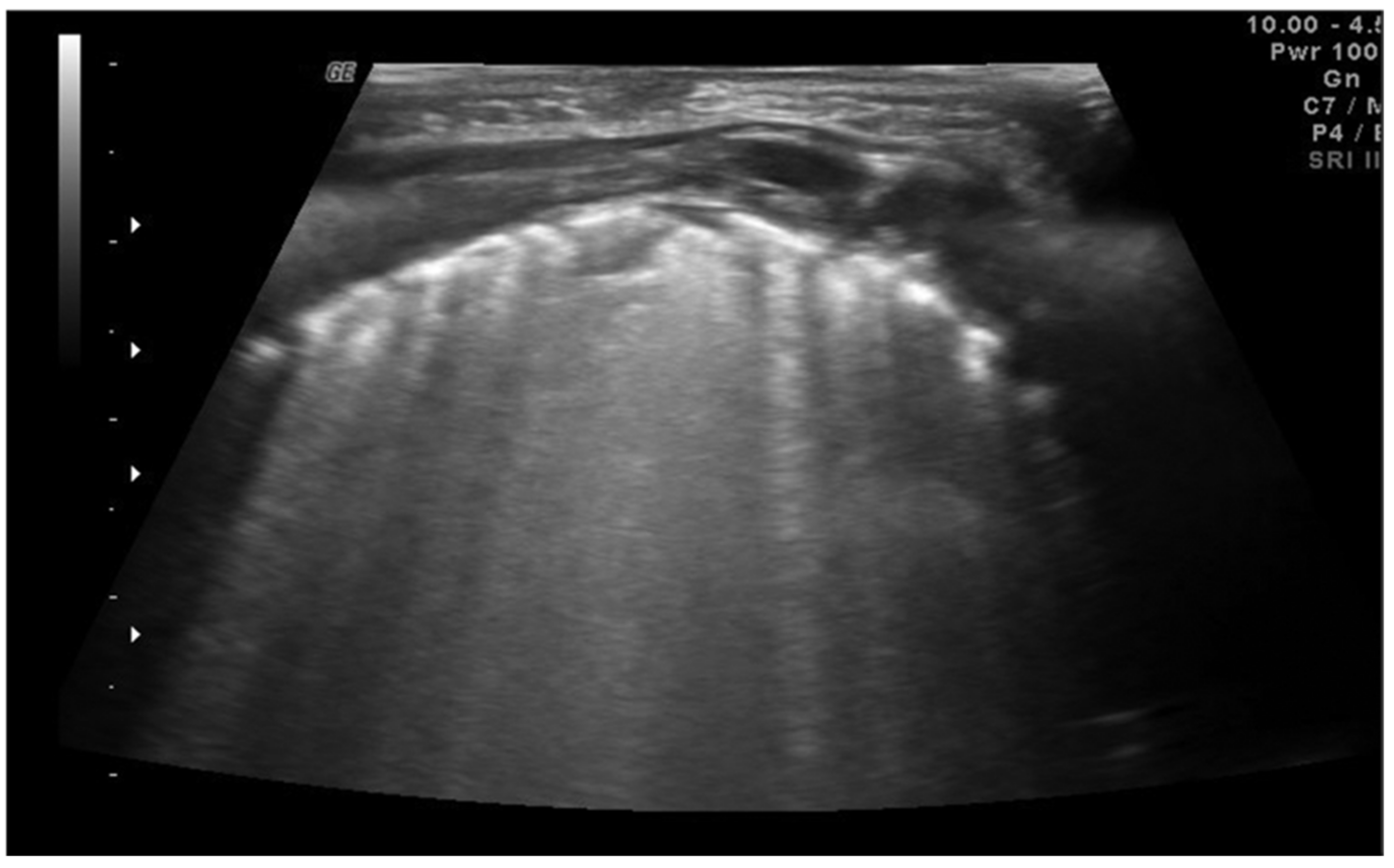 Diagnostics 11 00652 g004