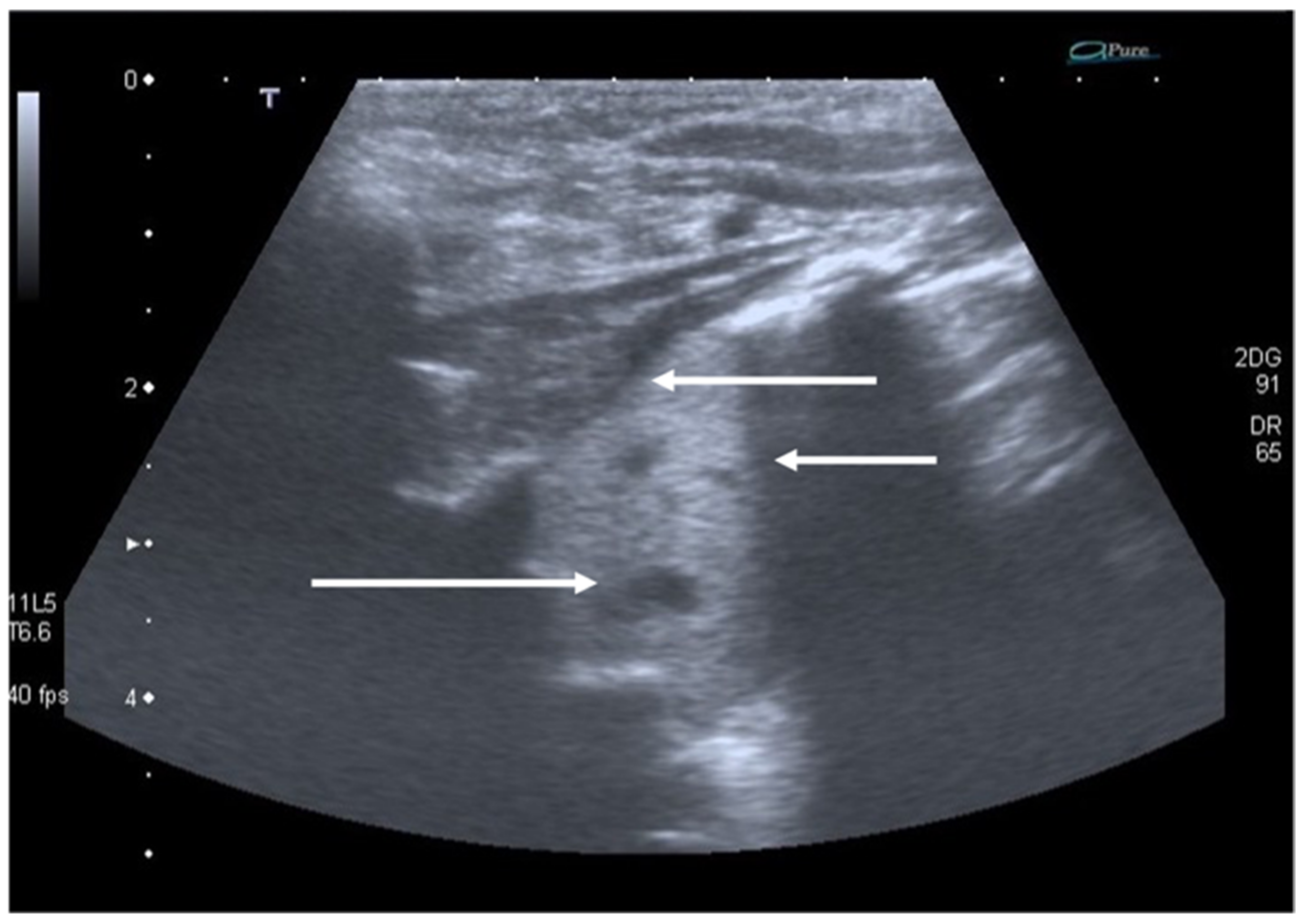 Diagnostics 11 00652 g006