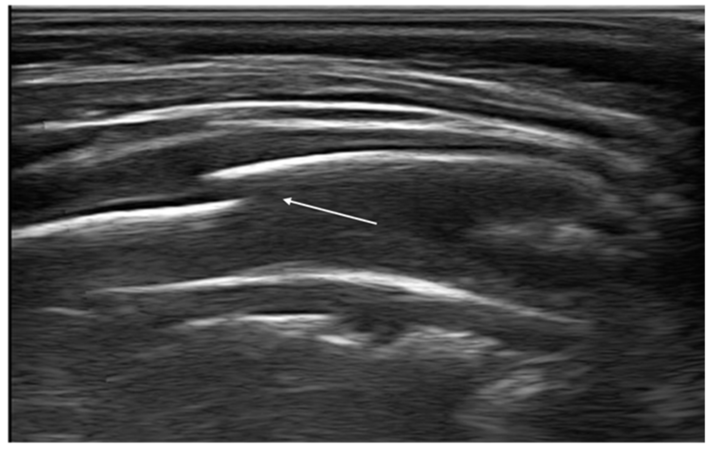 Diagnostics 11 00652 g013