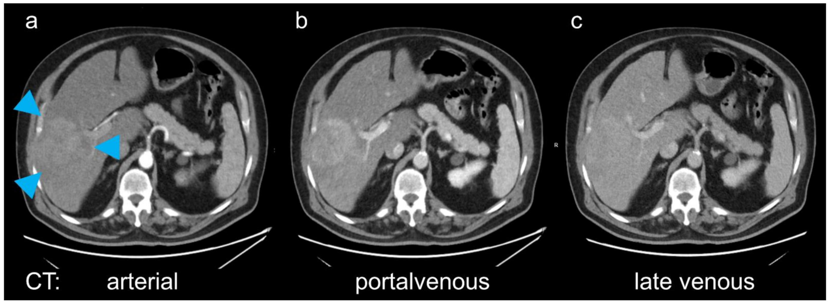 Diagnostics 11 00660 g001