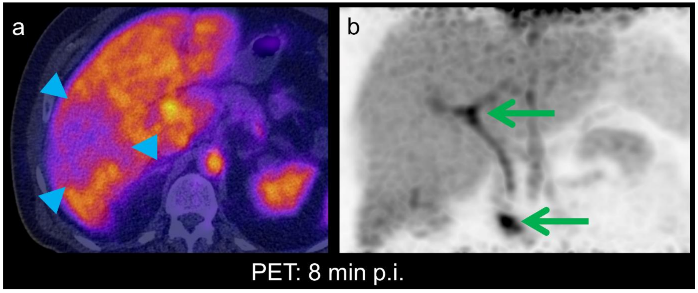 Diagnostics 11 00660 g004
