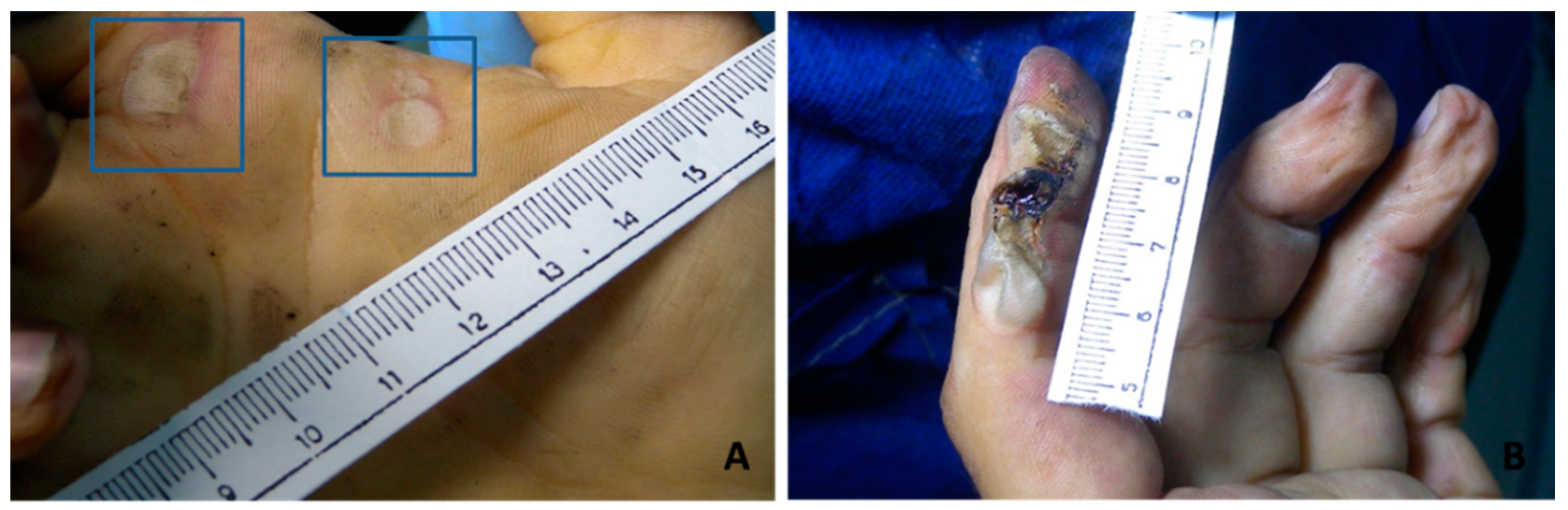 Diagnostics 11 00682 g001