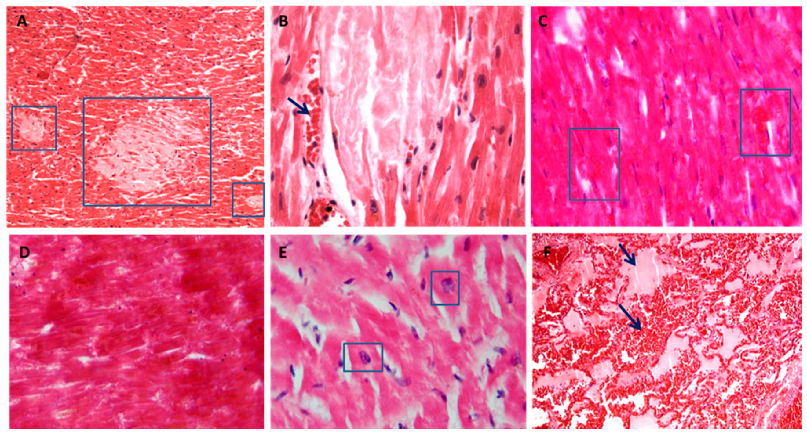 Diagnostics 11 00682 g004