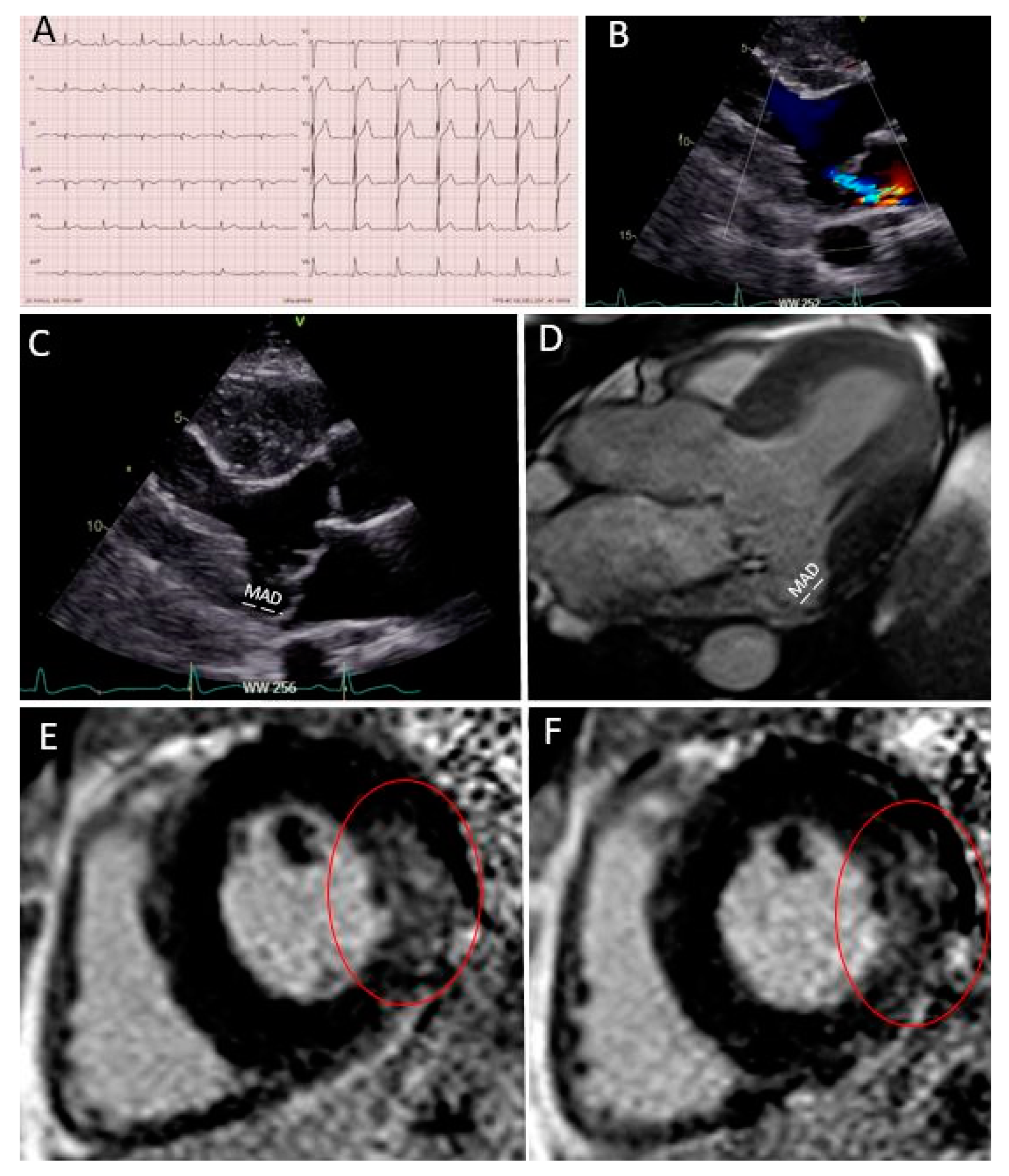 Diagnostics 11 00683 g003