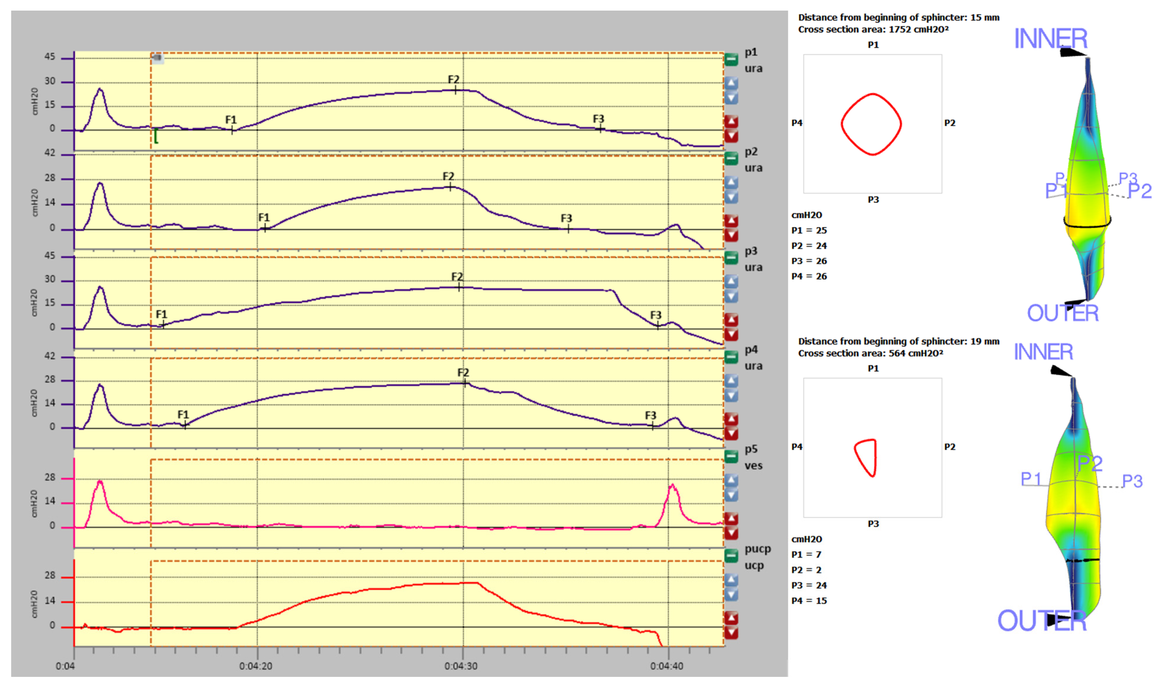 Diagnostics 11 00687 g006 Diagnostics 11 00687 g006