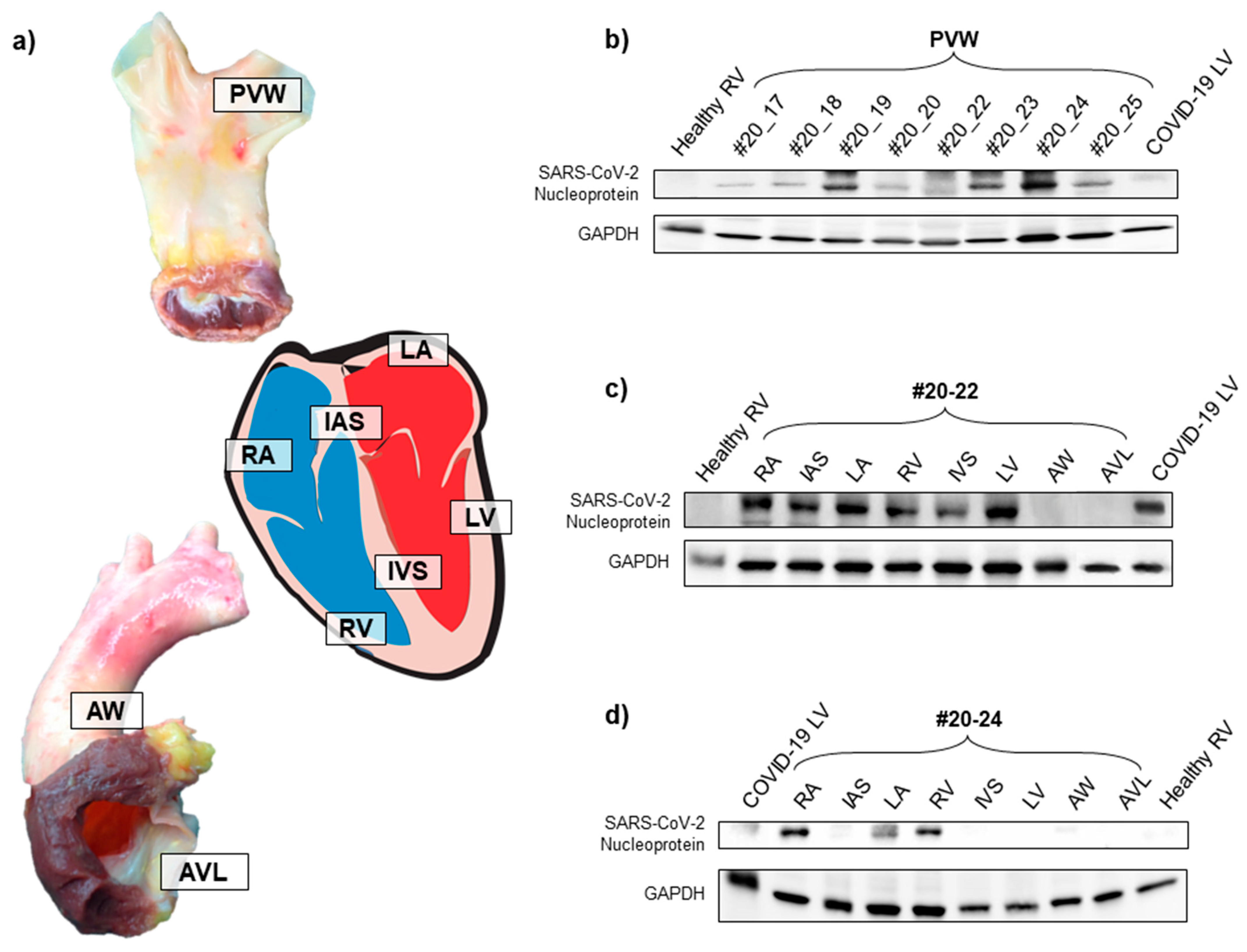 Diagnostics 11 00731 g001