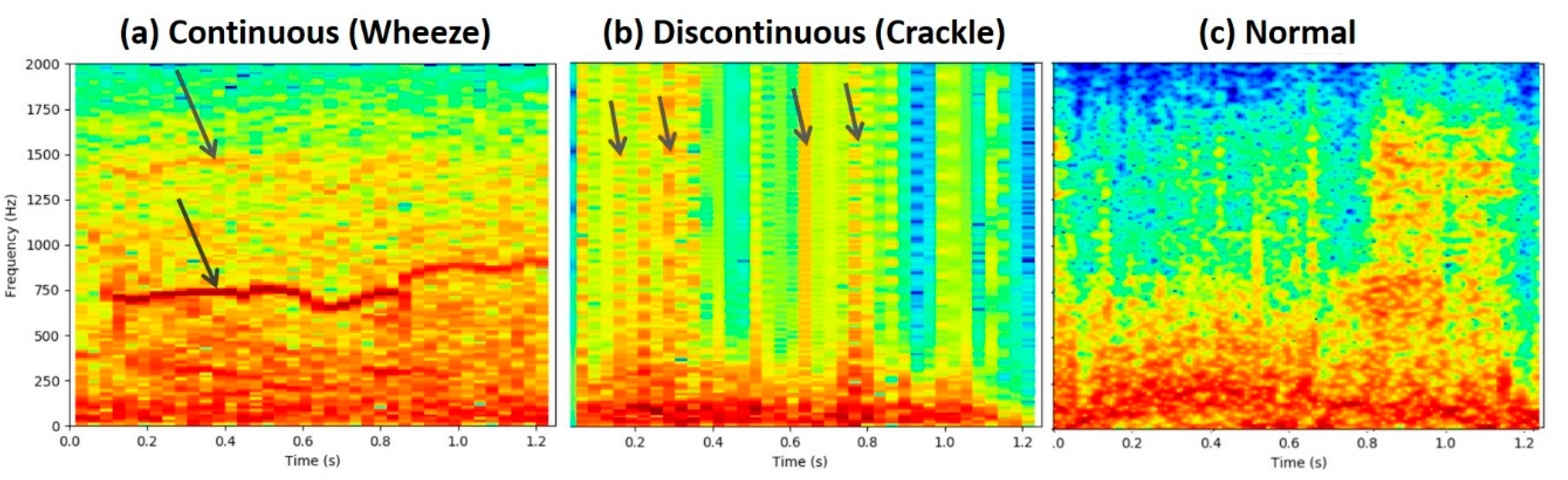 Diagnostics 11 00732 g002 Diagnostics 11 00732 g002