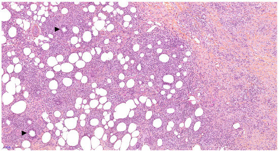 Diagnostics 11 00747 g002 550