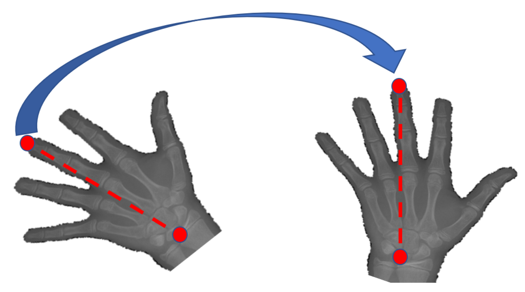 Diagnostics 11 00765 g004