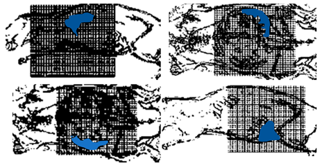 Diagnostics 11 00773 i006 Diagnostics 11 00773 i006