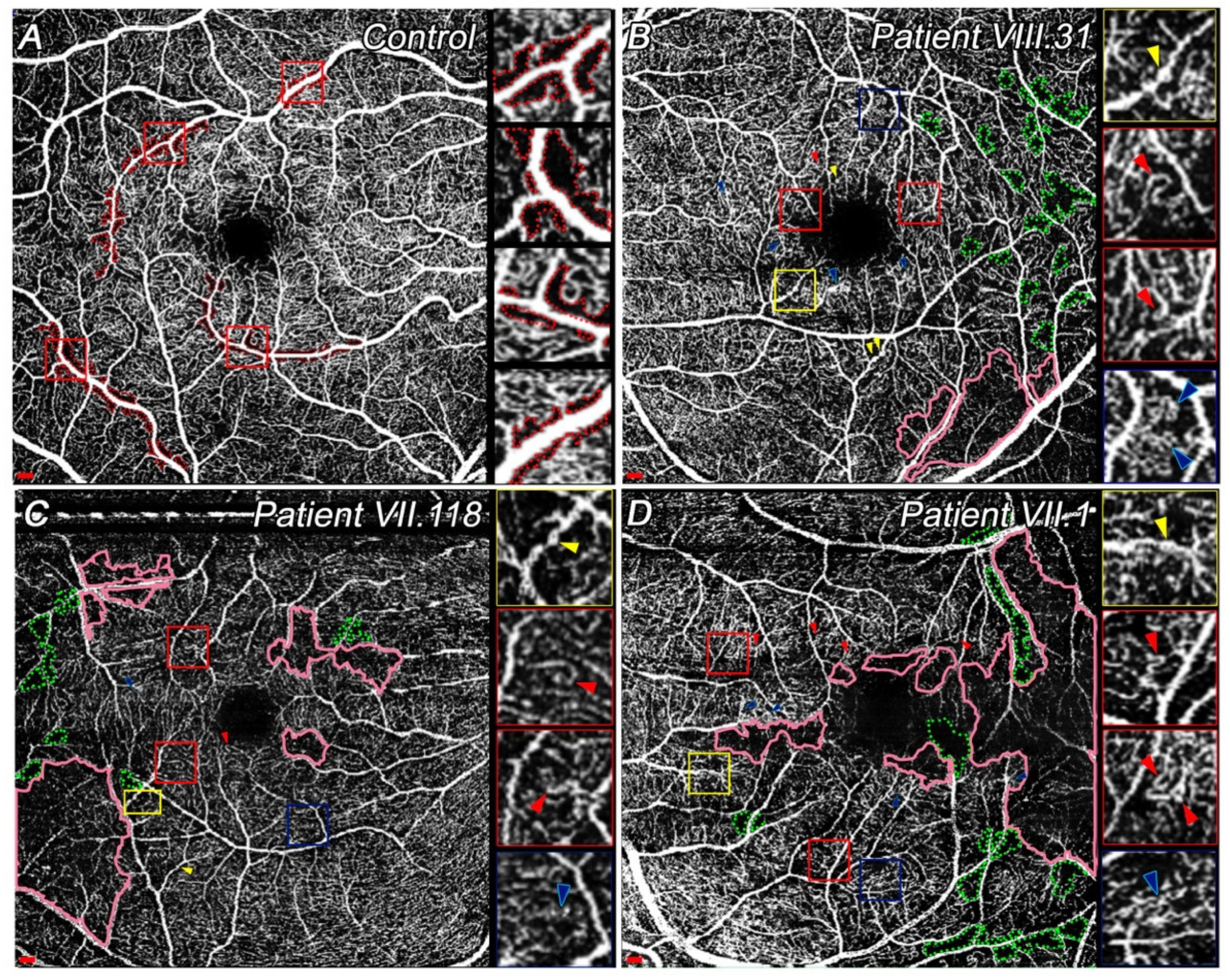 Diagnostics 11 00777 g003 Diagnostics 11 00777 g003