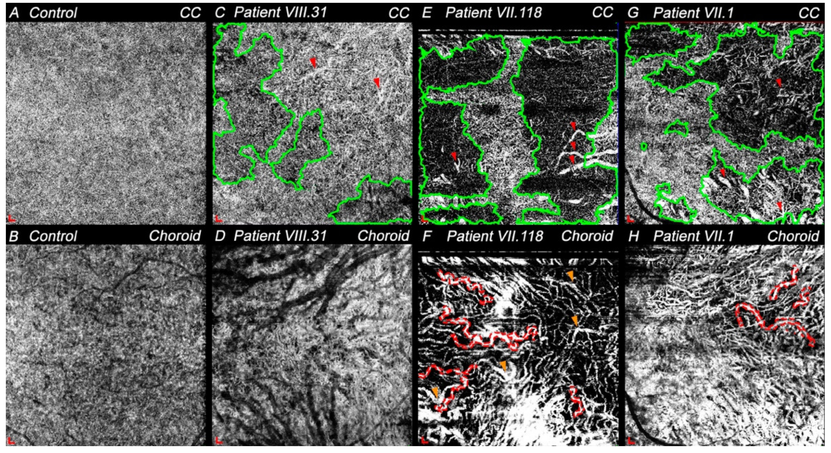Diagnostics 11 00777 g005 Diagnostics 11 00777 g005