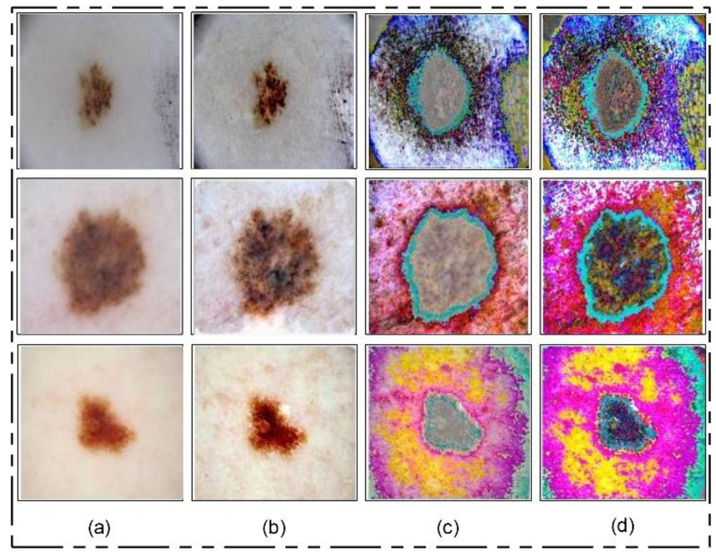 Diagnostics 11 00811 g006