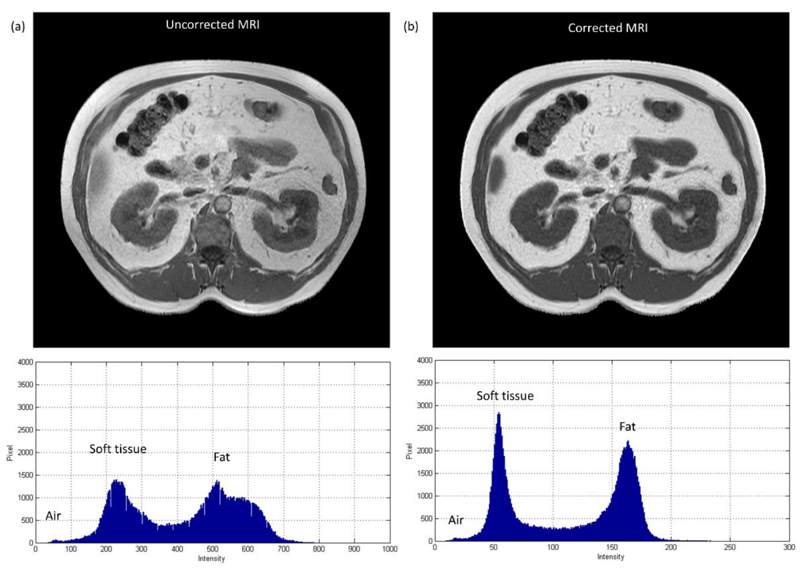 Diagnostics 11 00816 g010