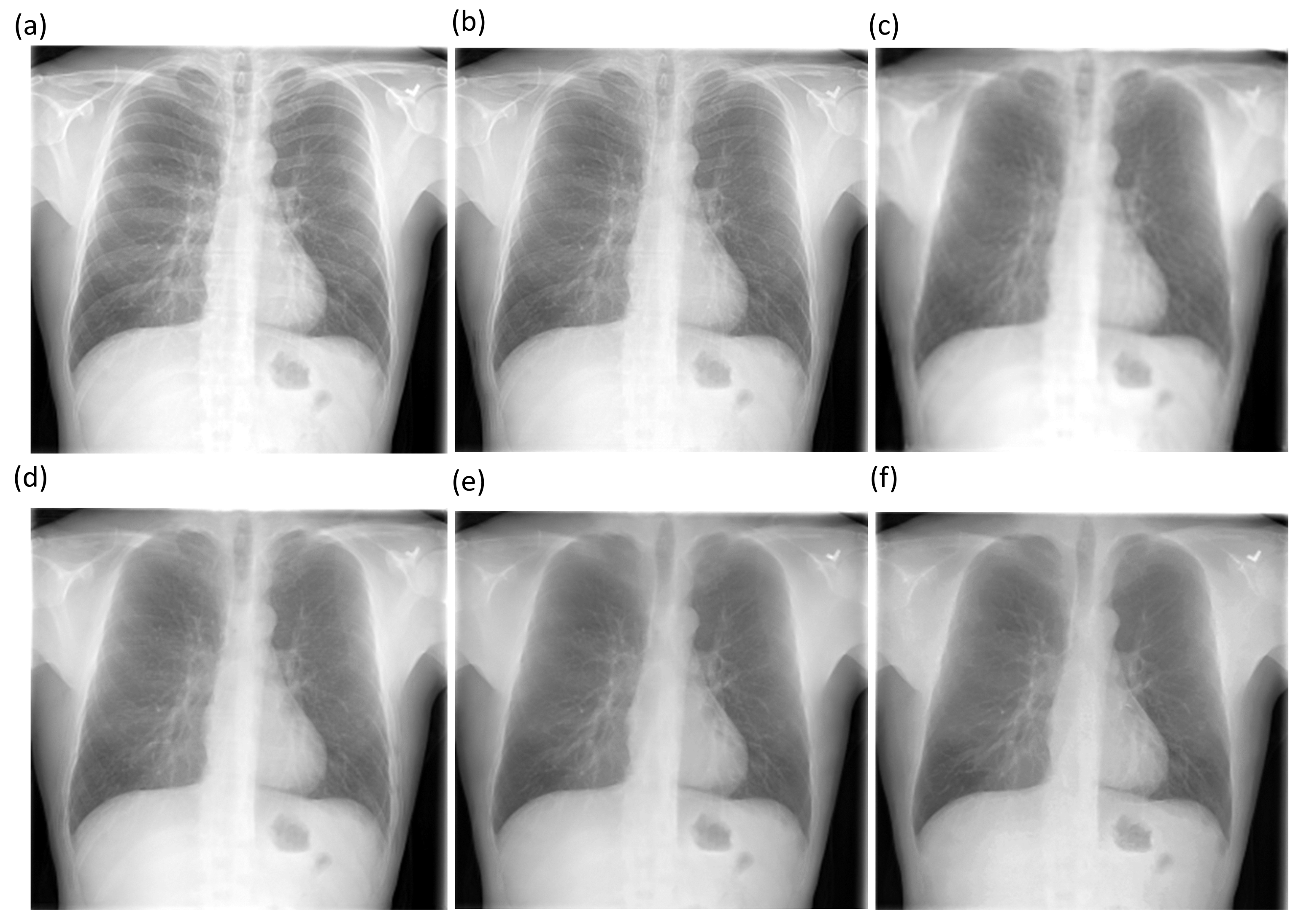 Diagnostics 11 00840 g005