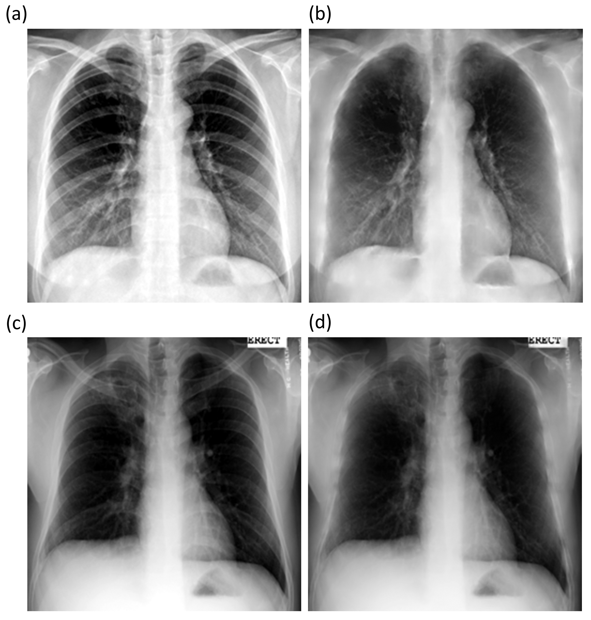 Diagnostics 11 00840 g007