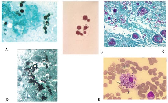 Diagnostics 11 00856 g001