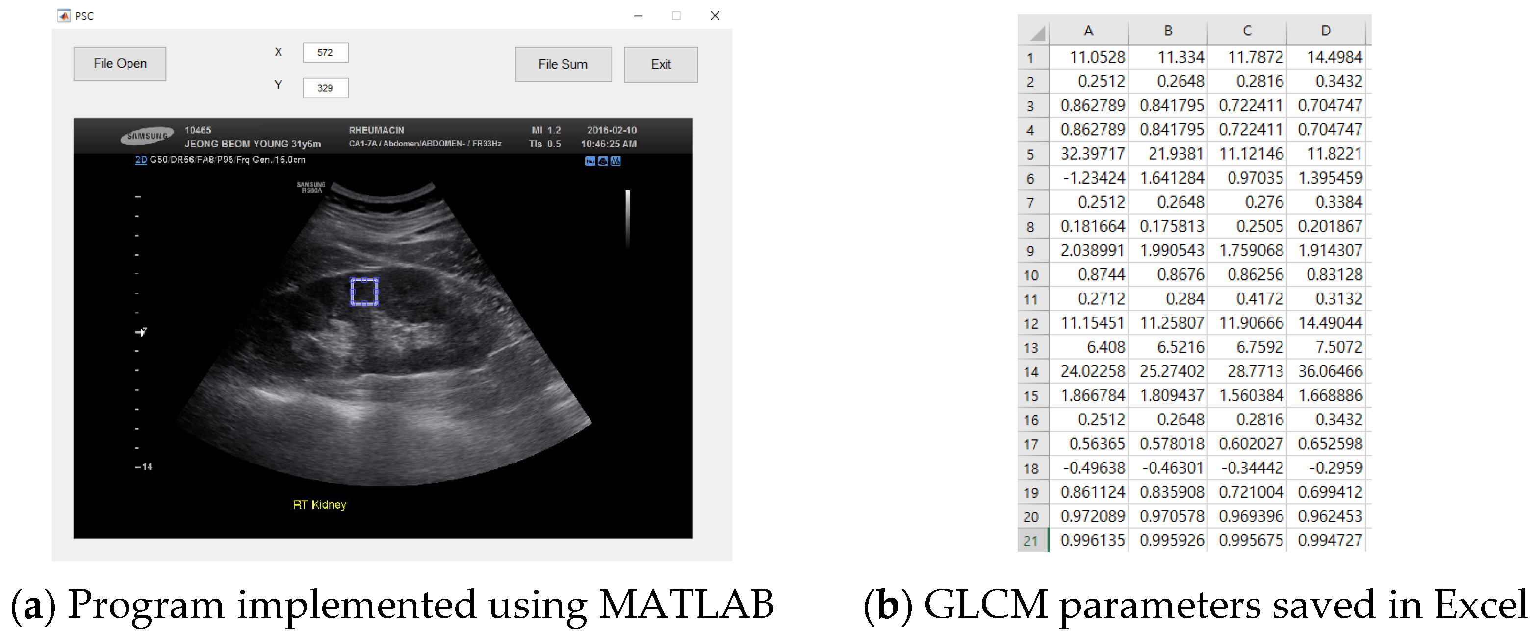 Diagnostics 11 00864 g003