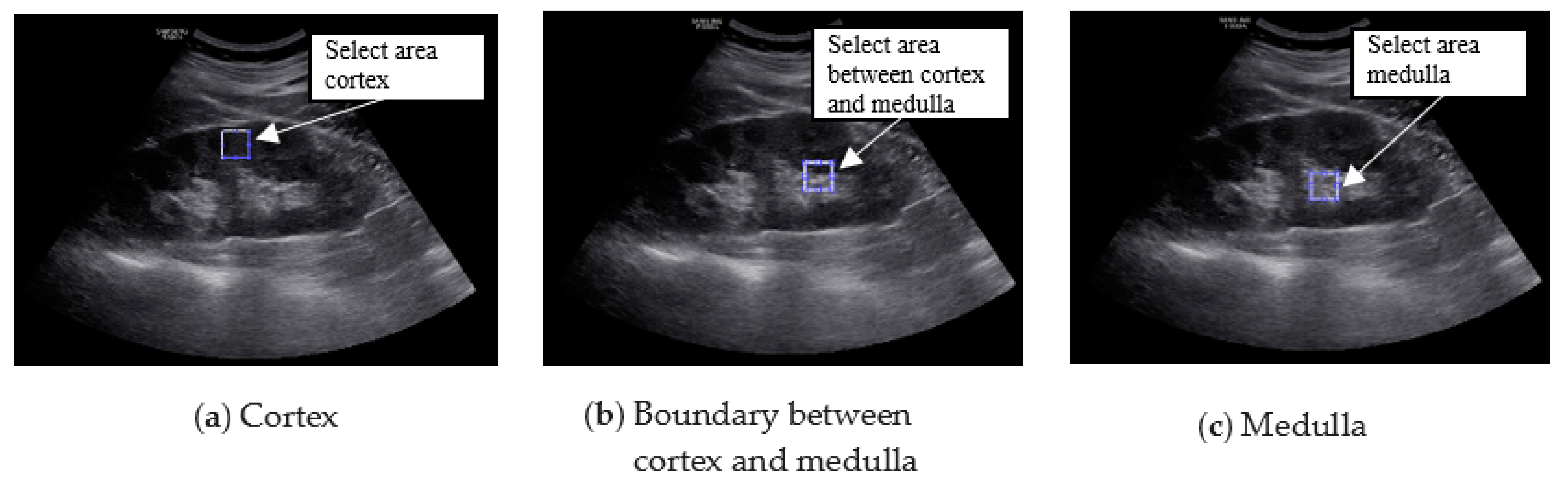 Diagnostics 11 00864 g005