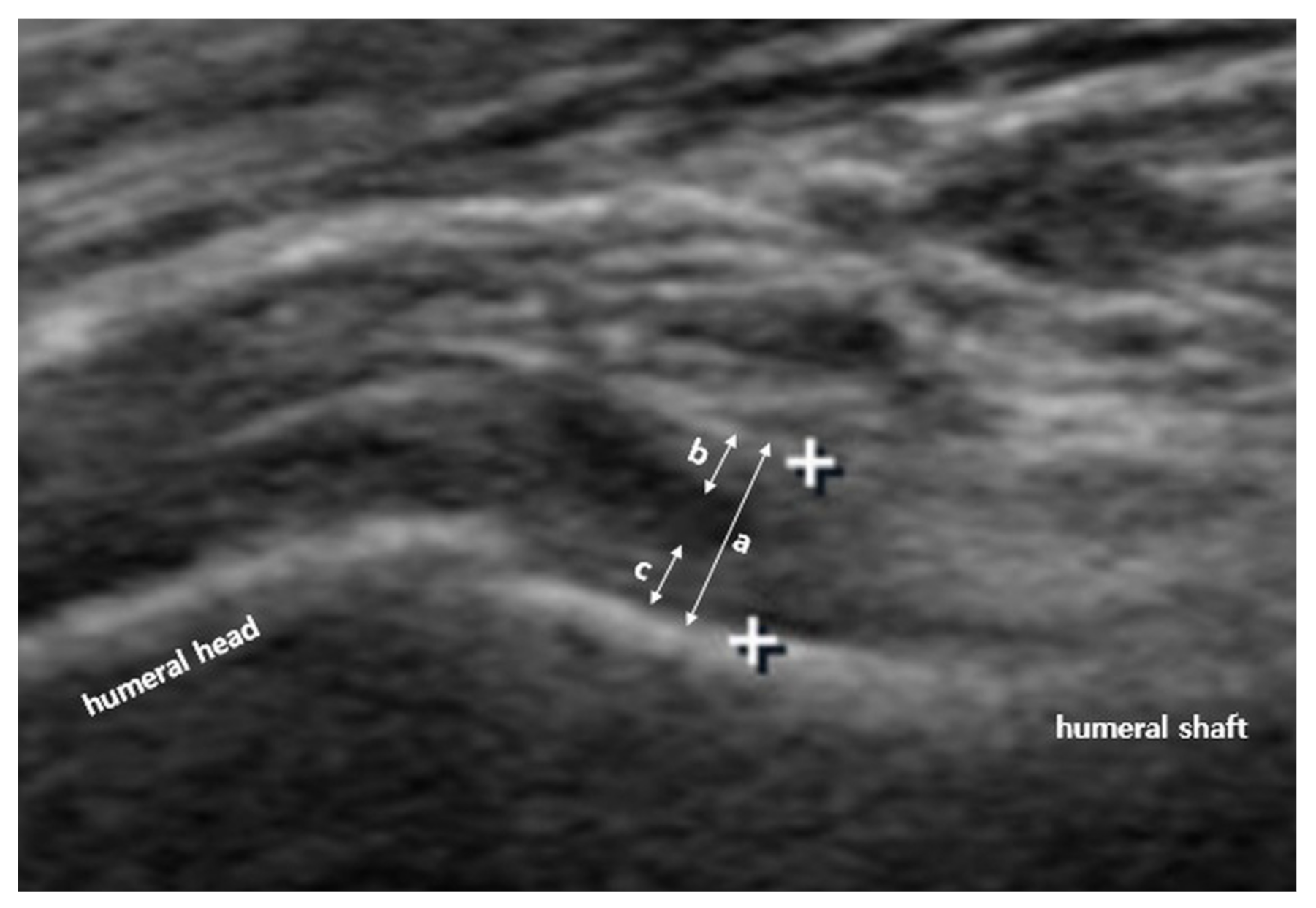 Diagnostics 11 00898 g002