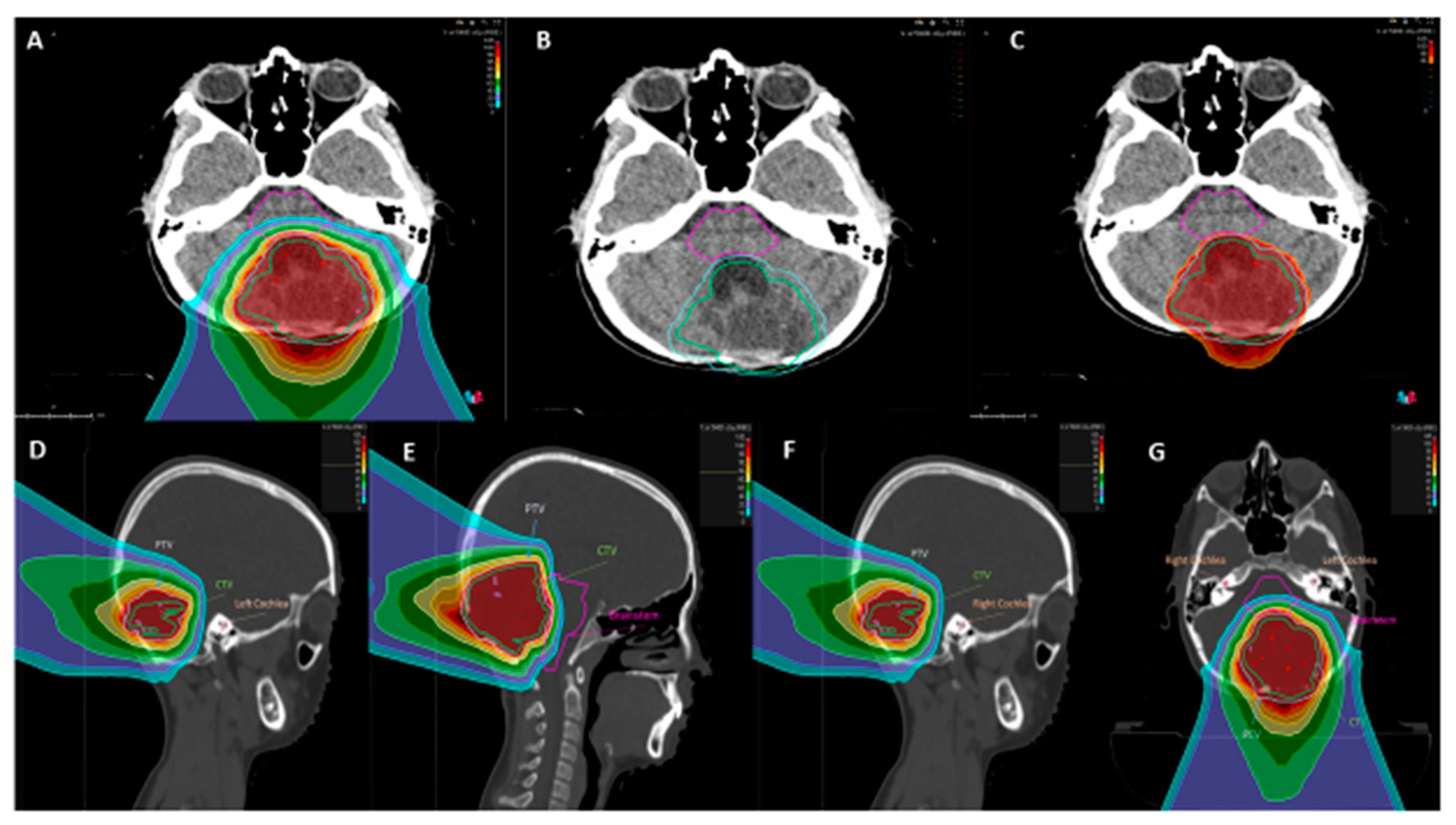 Diagnostics 11 00903 g003 Diagnostics 11 00903 g003