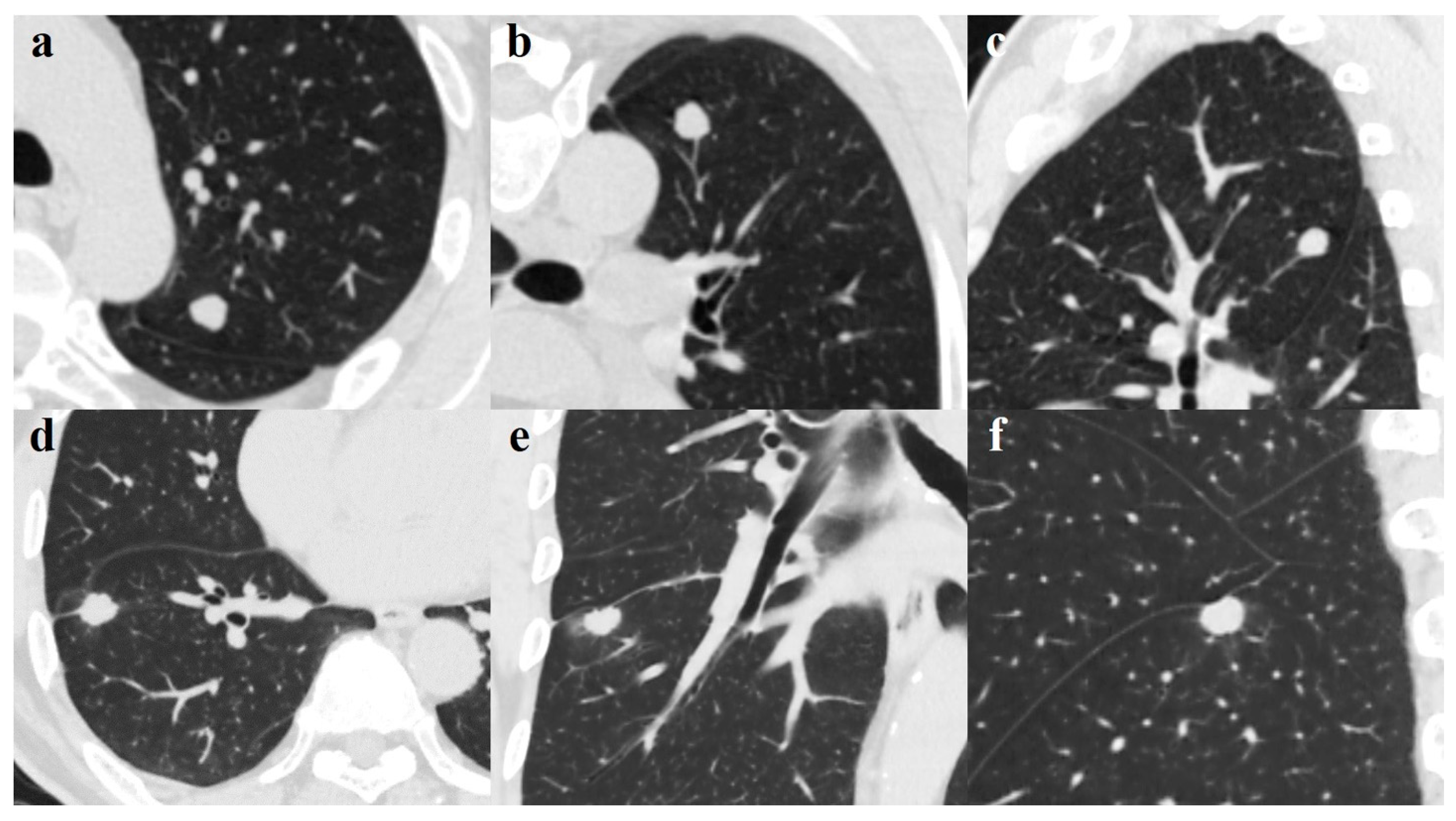 Diagnostics 11 00930 g003
