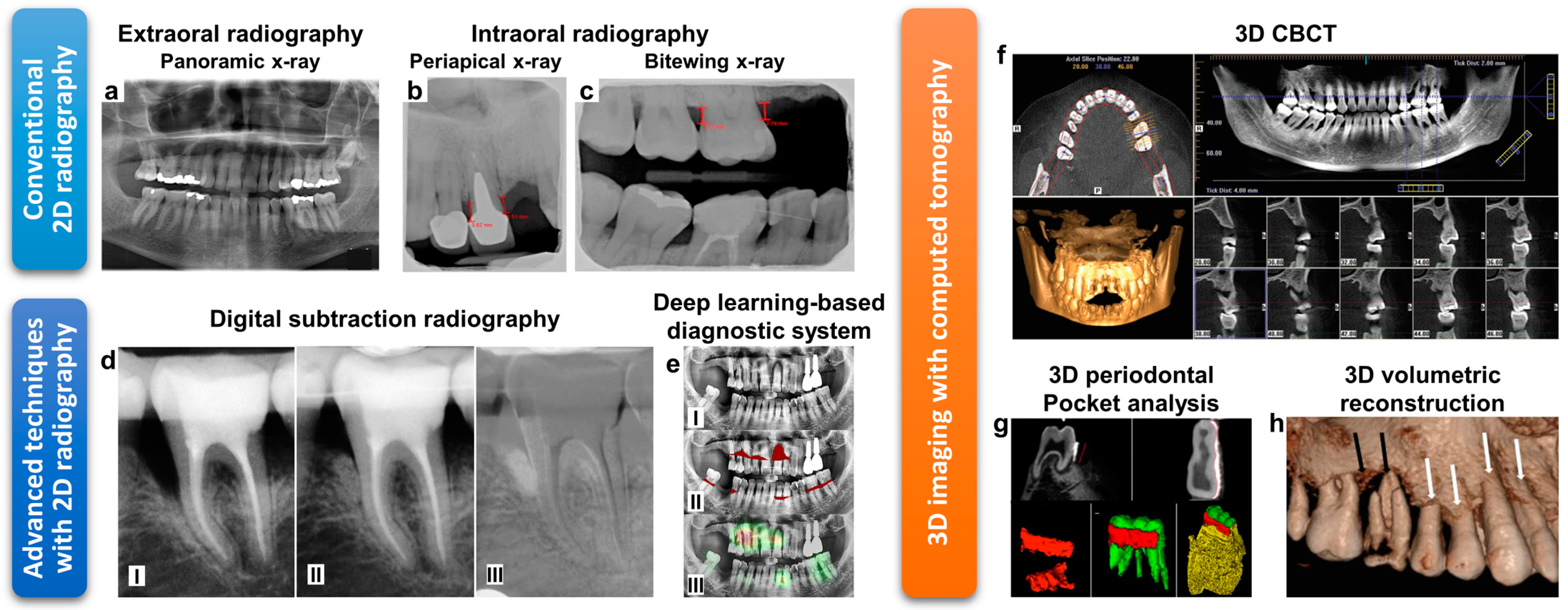 Diagnostics 11 00932 g002