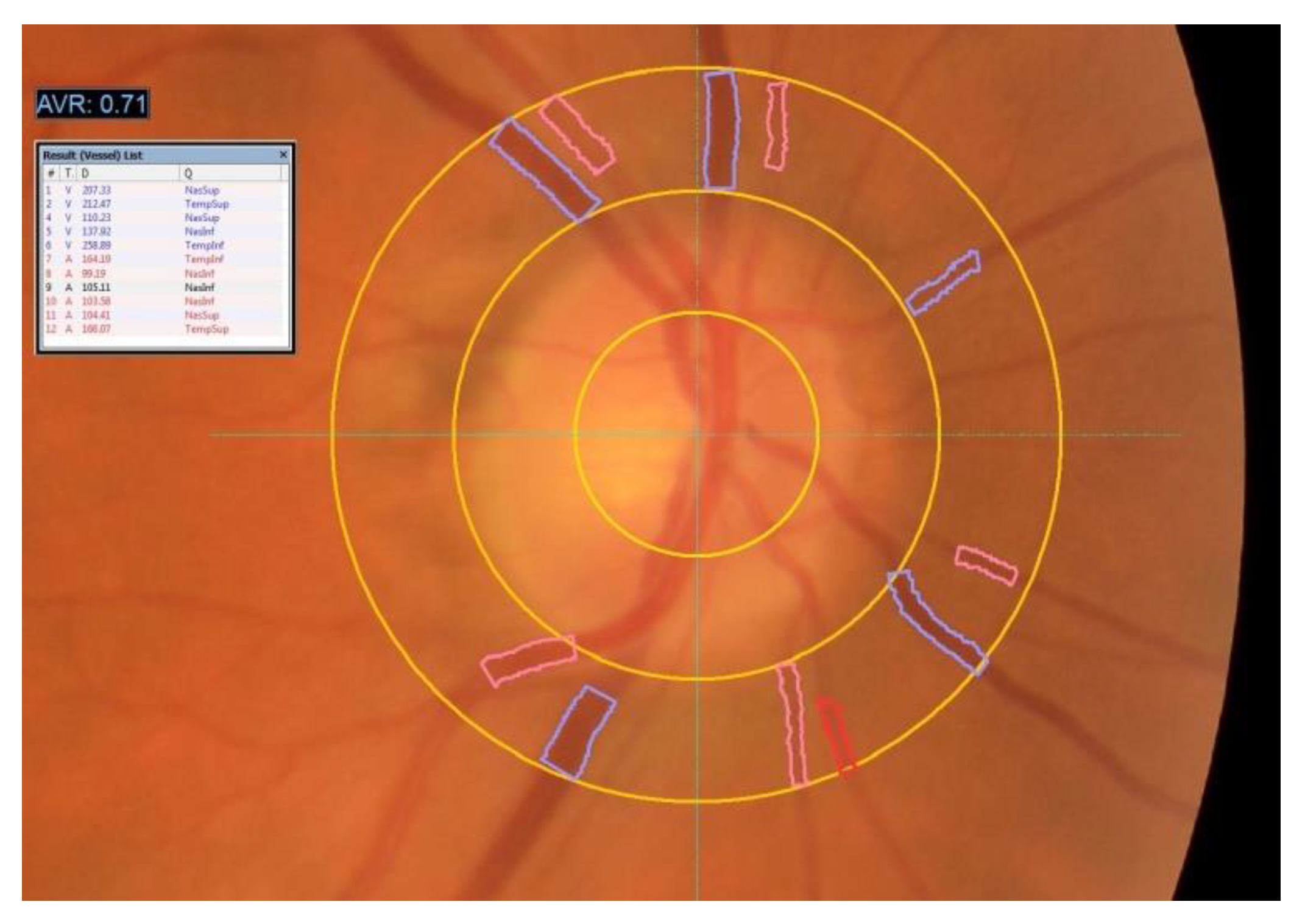 Diagnostics 11 00937 g001