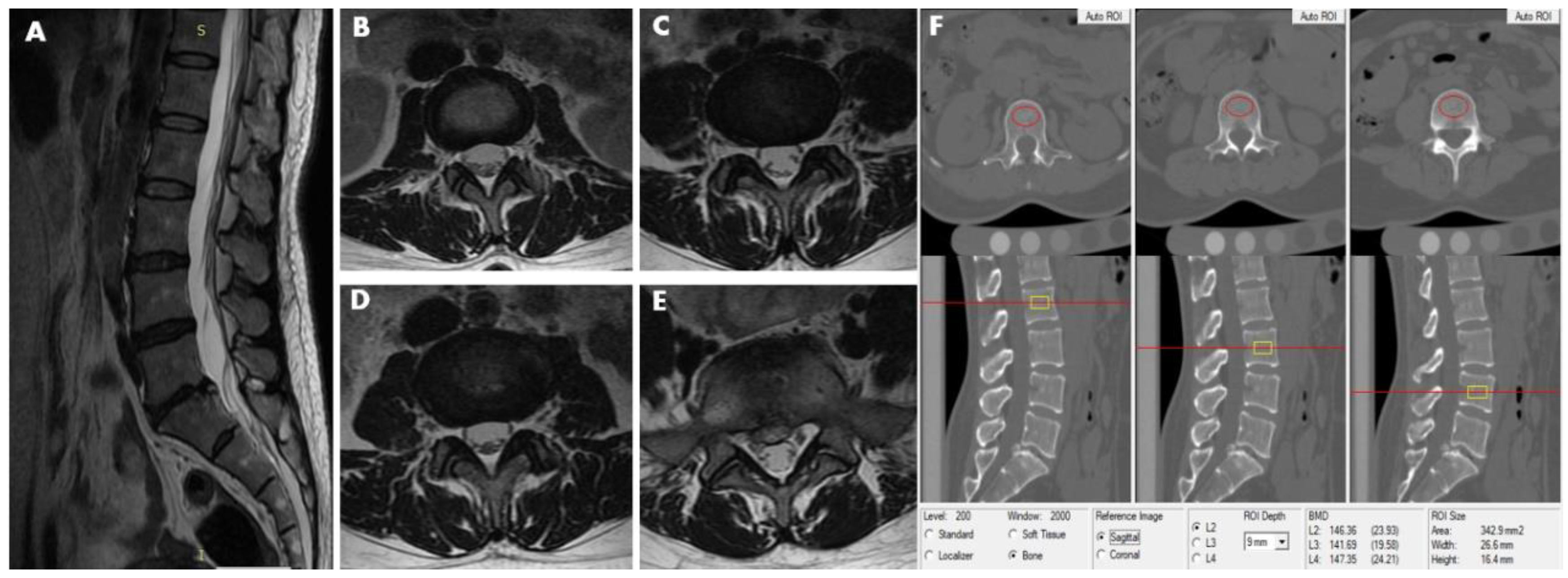 Diagnostics 11 00938 g002 Diagnostics 11 00938 g002