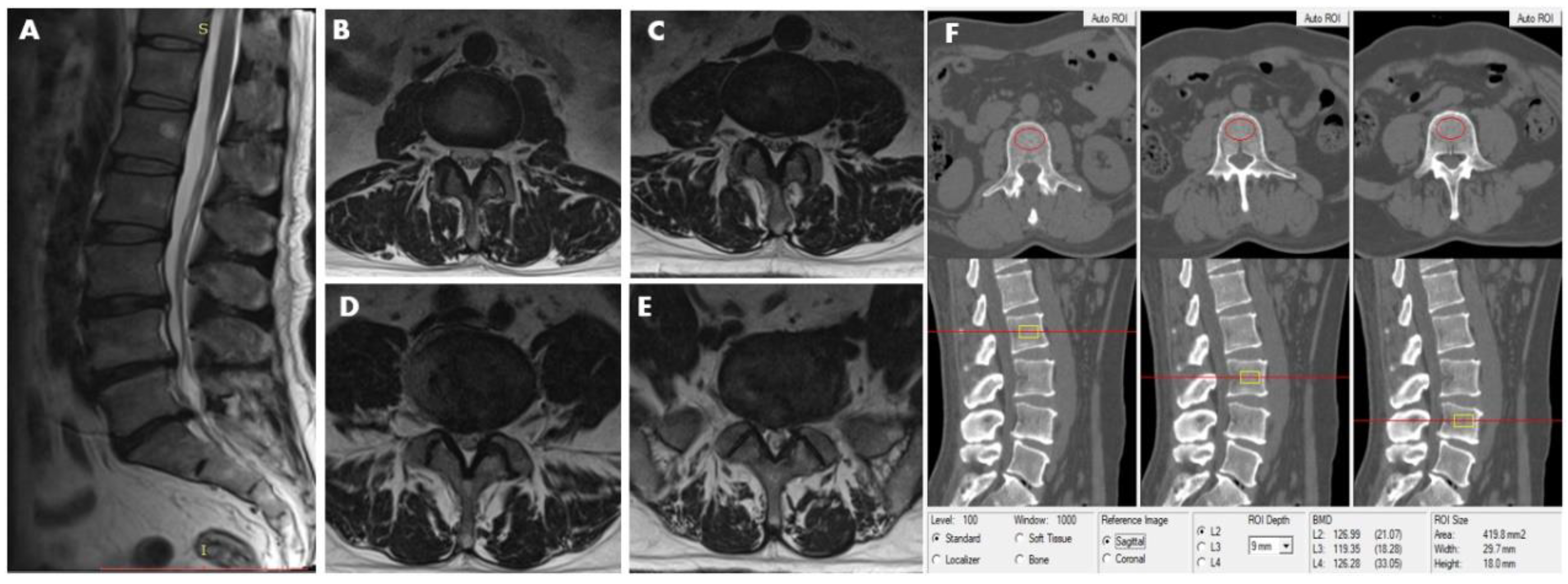 Diagnostics 11 00938 g003 Diagnostics 11 00938 g003