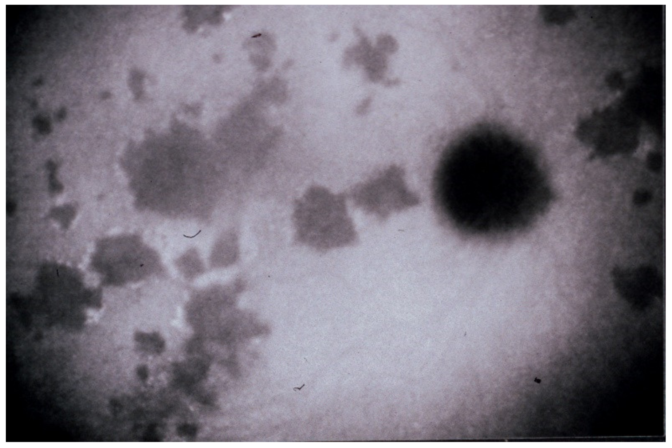 Diagnostics 11 00939 g004 Diagnostics 11 00939 g004