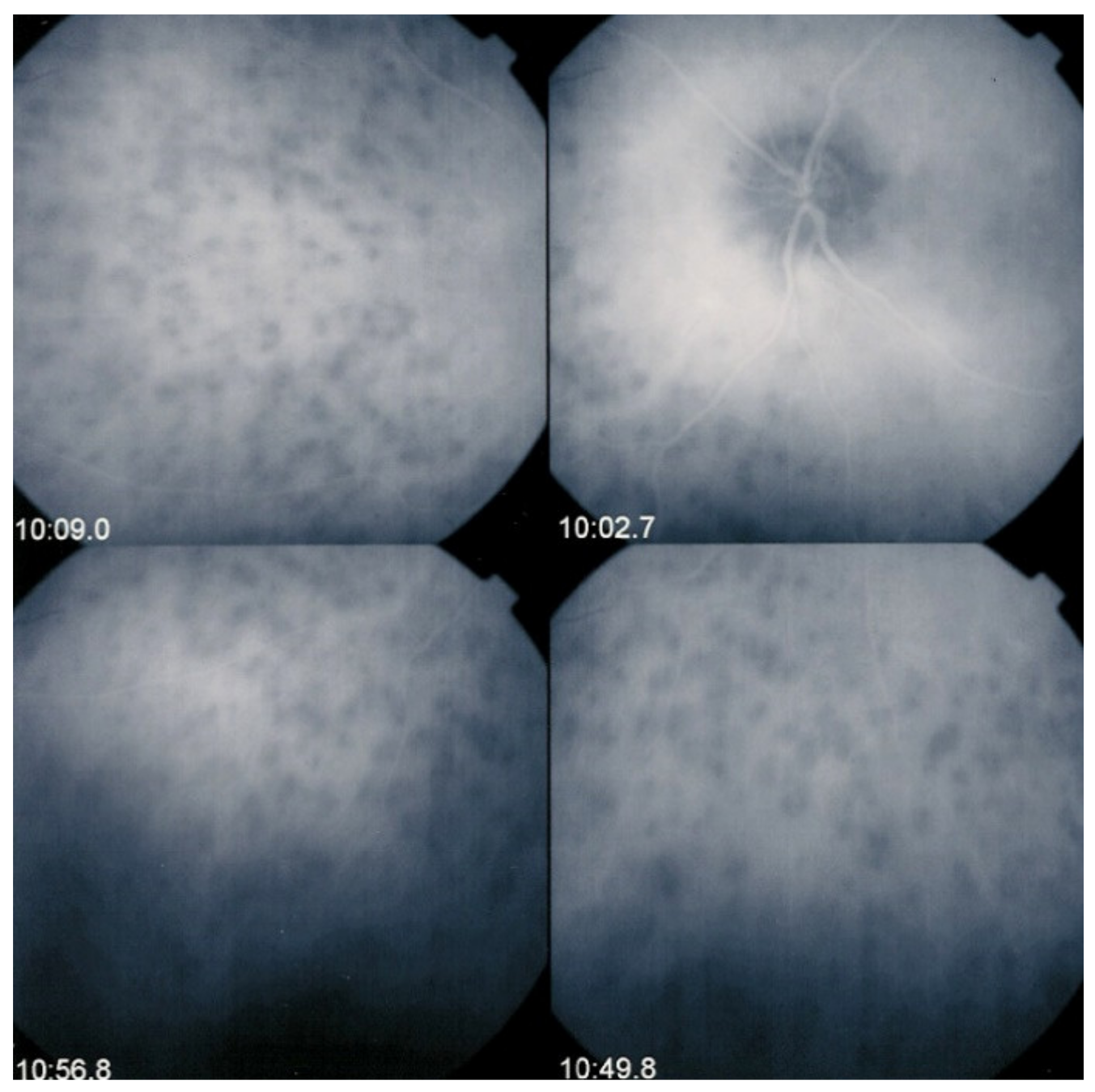 Diagnostics 11 00939 g005 Diagnostics 11 00939 g005