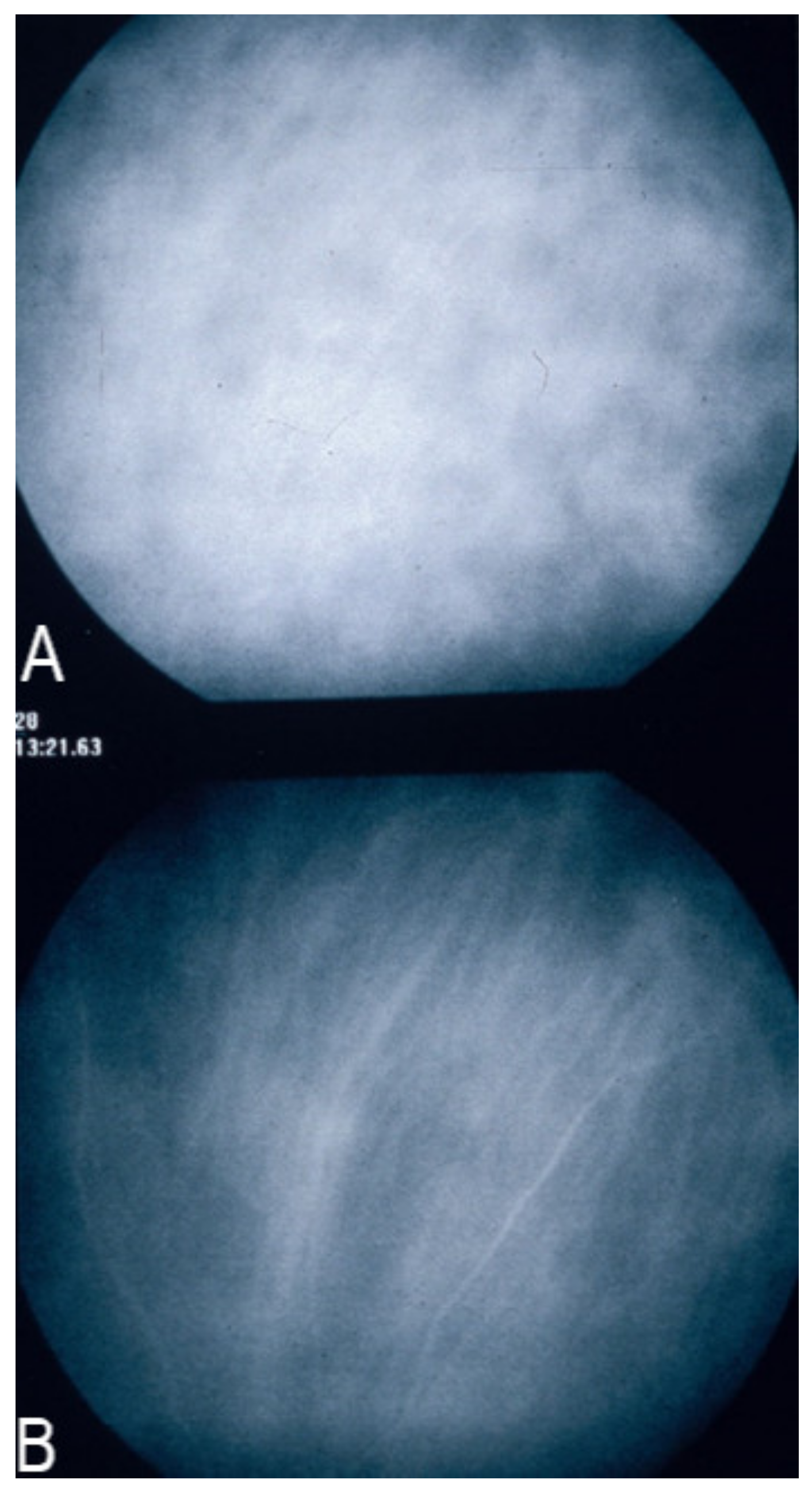 Diagnostics 11 00939 g006 Diagnostics 11 00939 g006