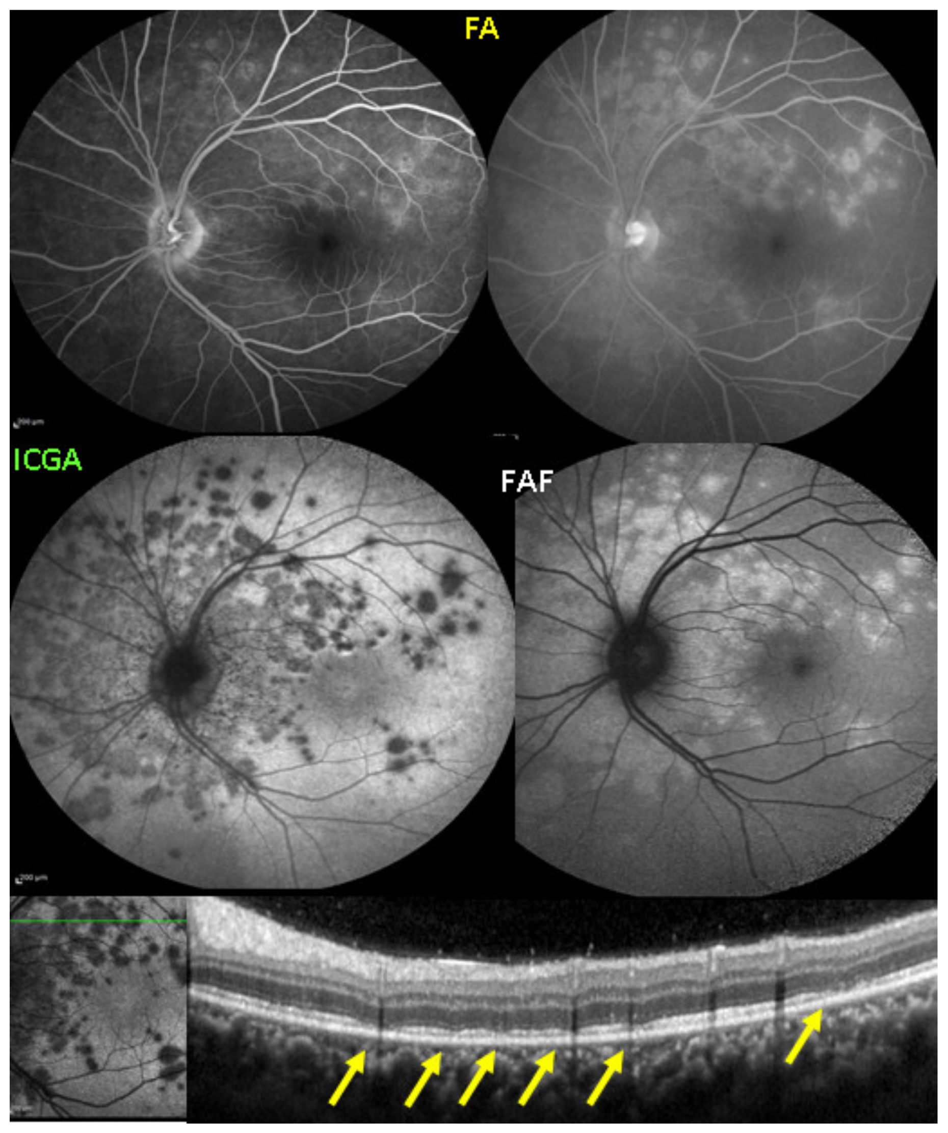 Diagnostics 11 00939 g008 Diagnostics 11 00939 g008