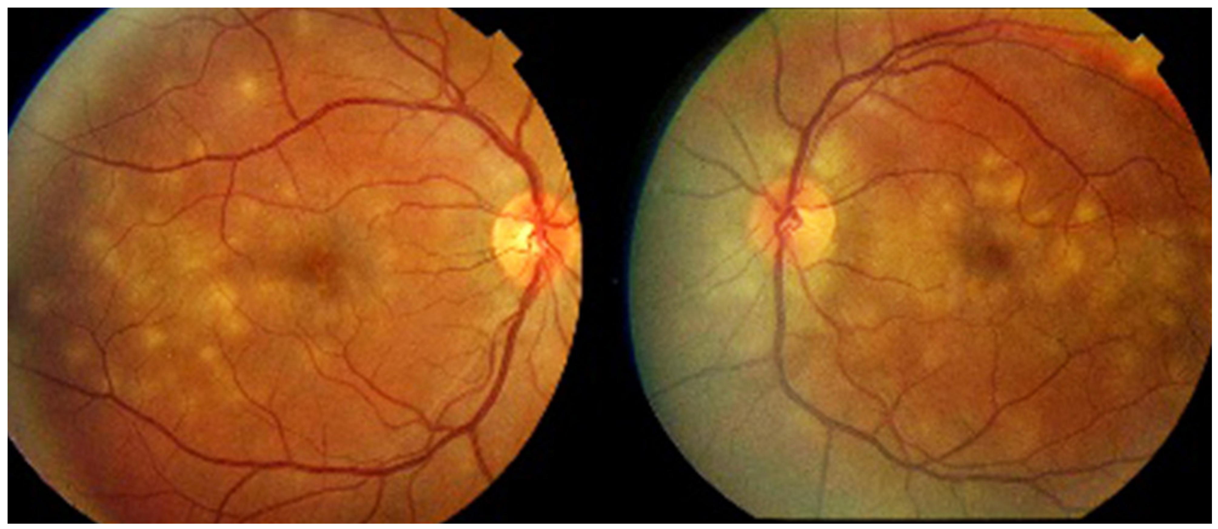 Diagnostics 11 00939 g009 Diagnostics 11 00939 g009