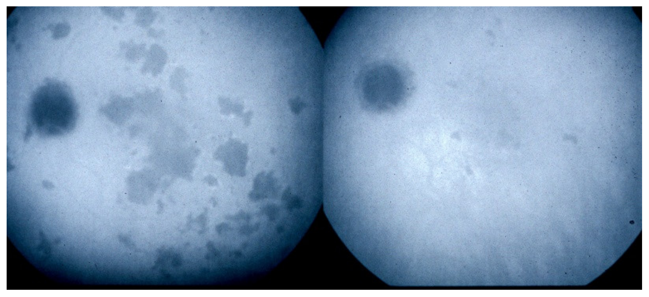 Diagnostics 11 00939 g010 Diagnostics 11 00939 g010