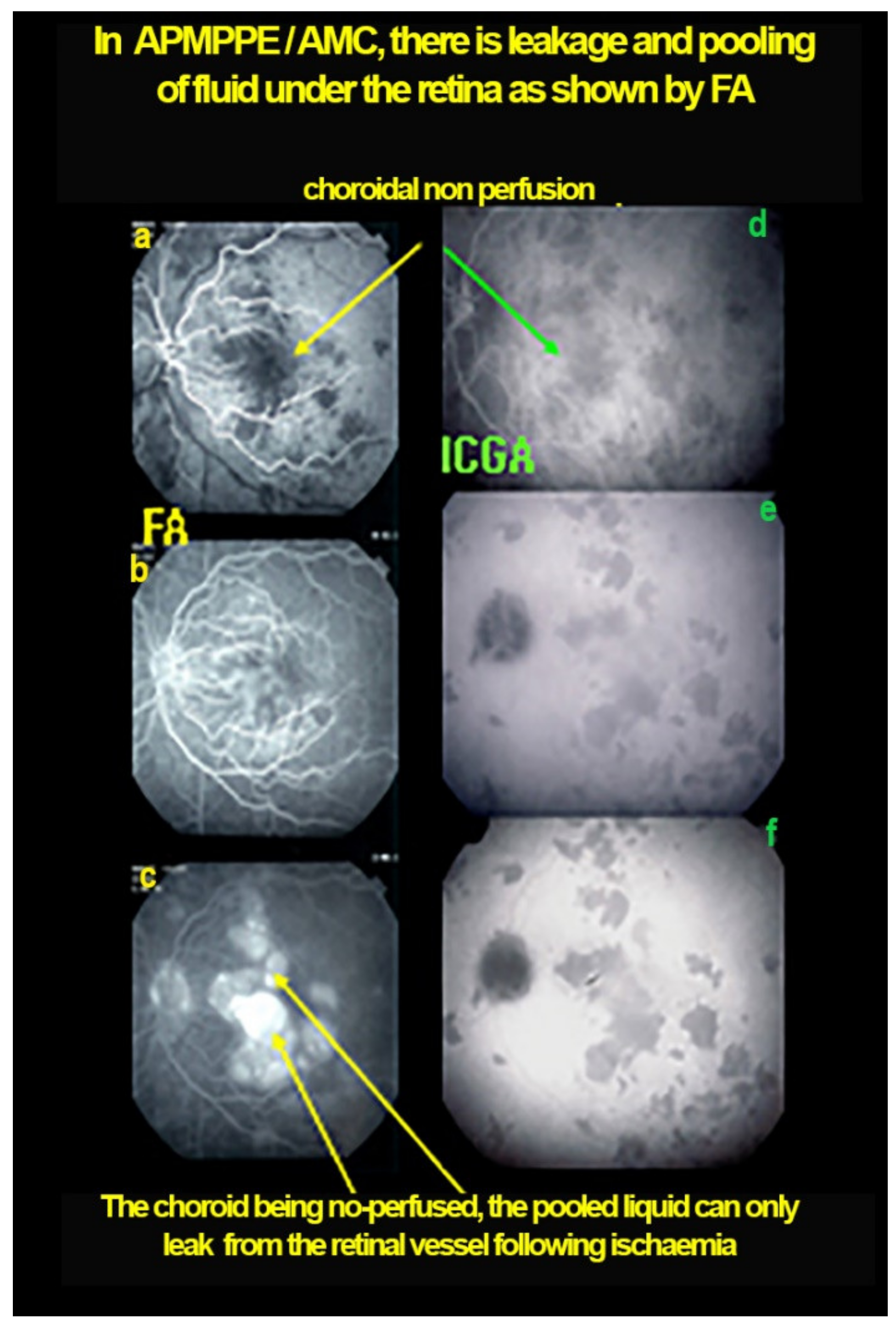 Diagnostics 11 00939 g012 Diagnostics 11 00939 g012