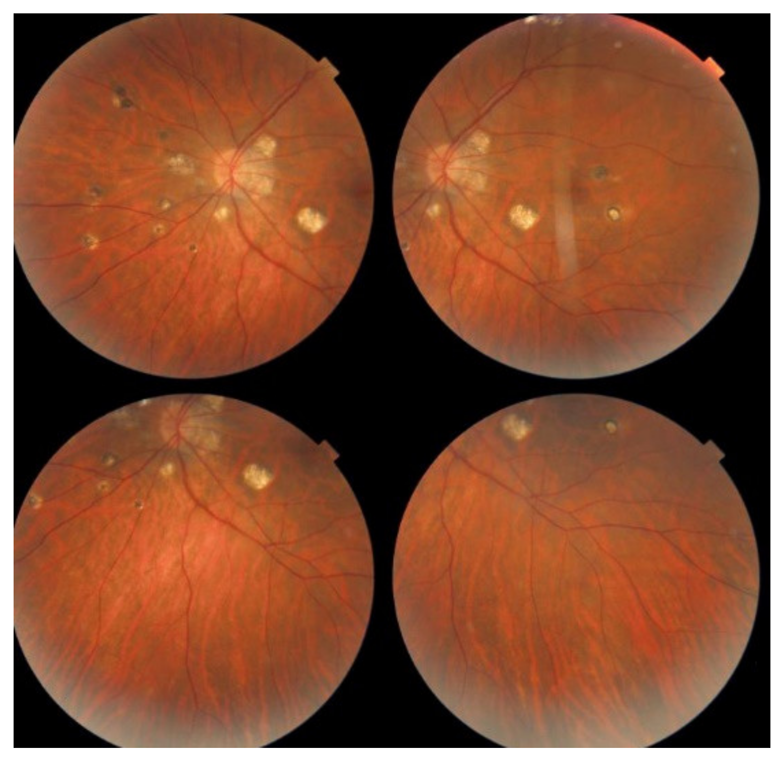 Diagnostics 11 00939 g013 Diagnostics 11 00939 g013