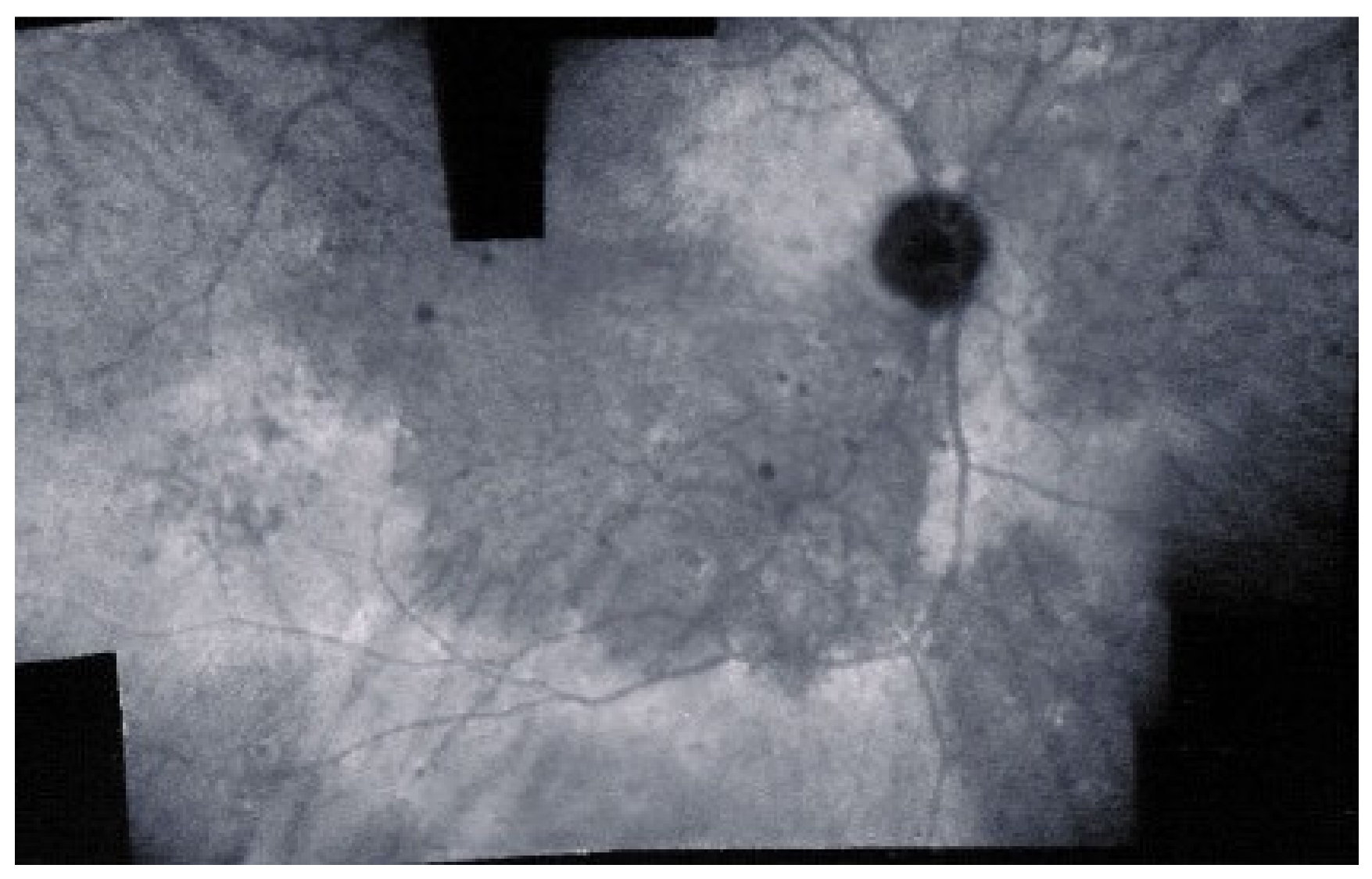 Diagnostics 11 00939 g015 Diagnostics 11 00939 g015