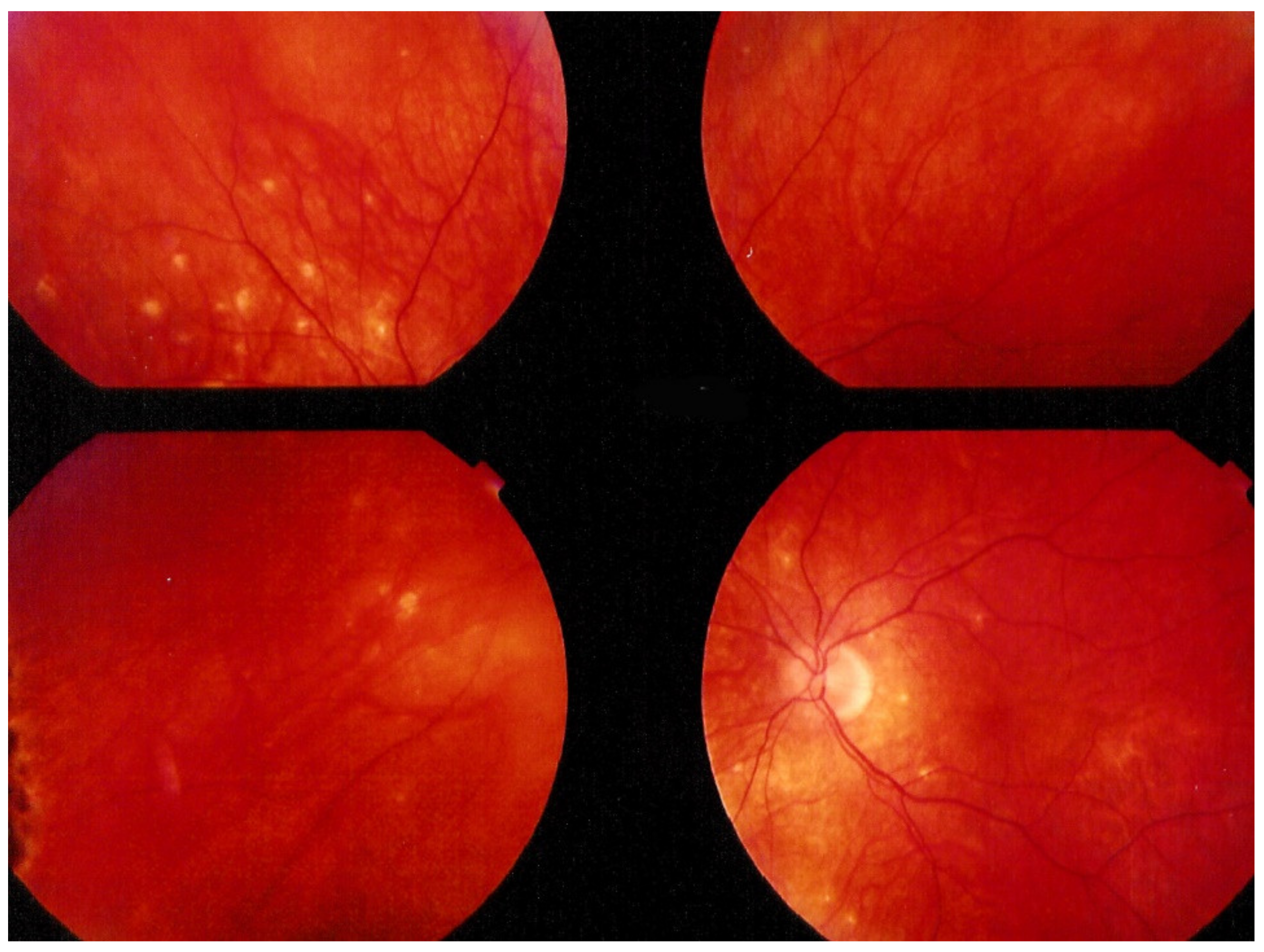 Diagnostics 11 00939 g018 Diagnostics 11 00939 g018