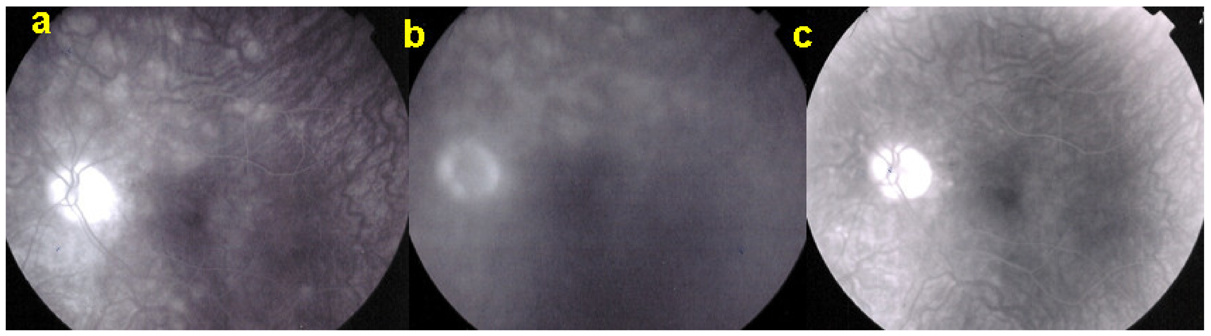 Diagnostics 11 00939 g019 Diagnostics 11 00939 g019