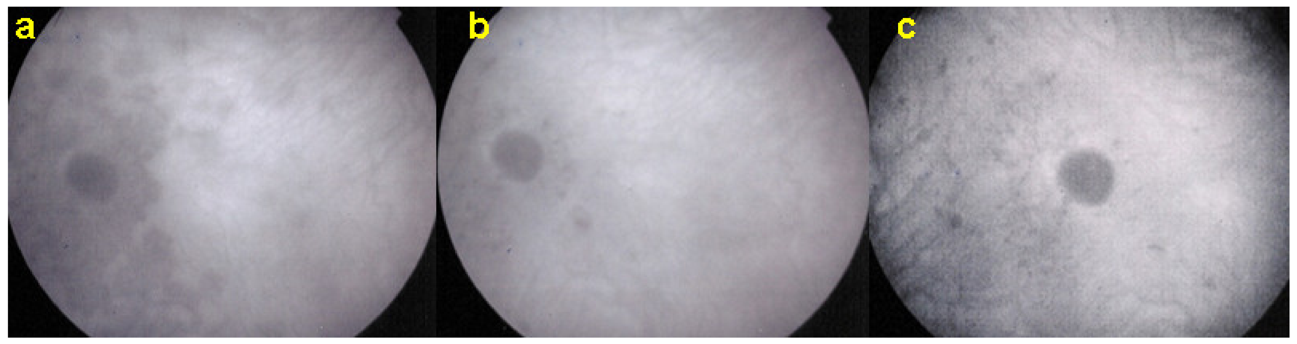 Diagnostics 11 00939 g020 Diagnostics 11 00939 g020